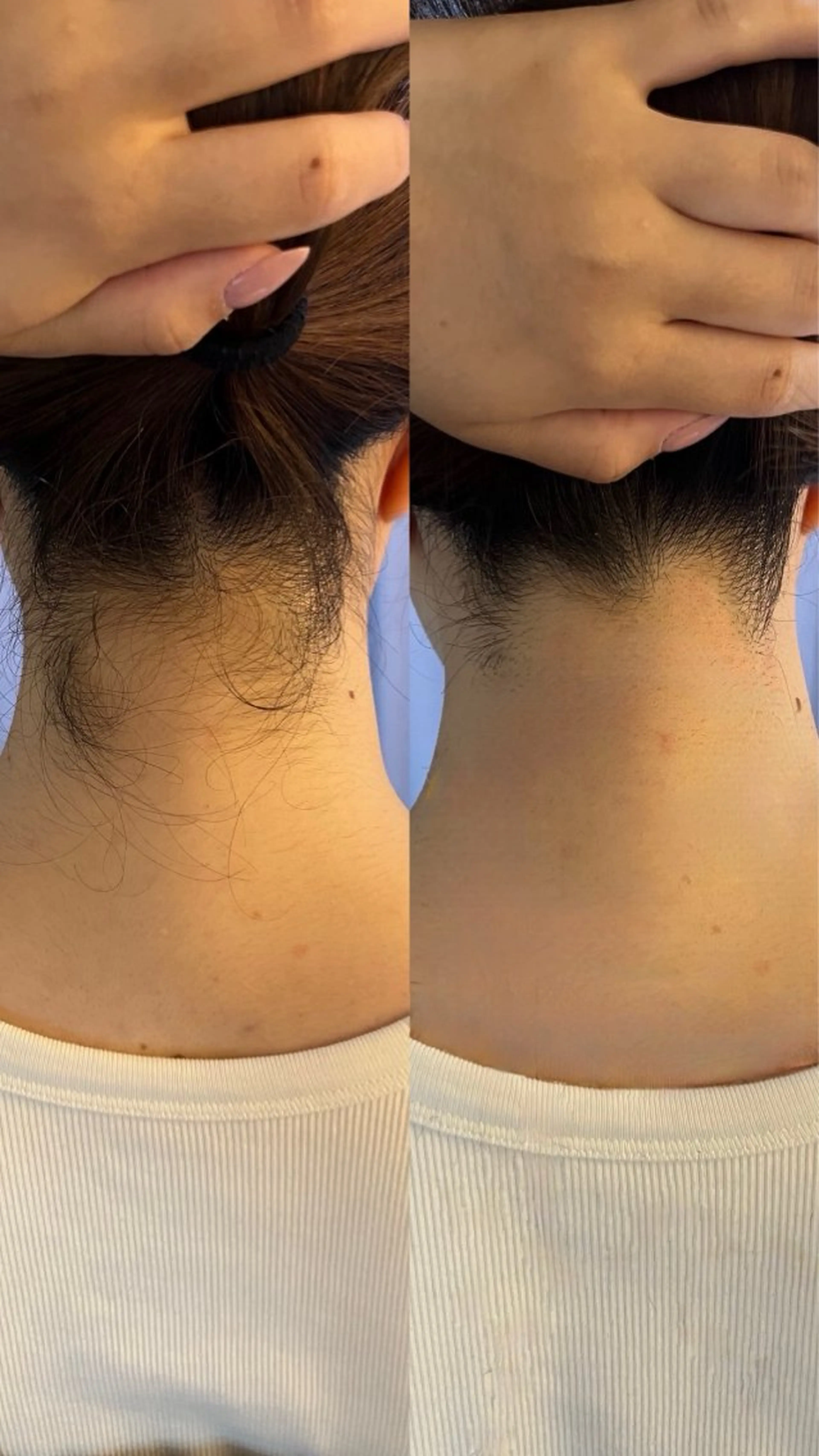 脱毛 うなじ脱毛/美肌脱毛 LABELのエステ・リラクイメージ