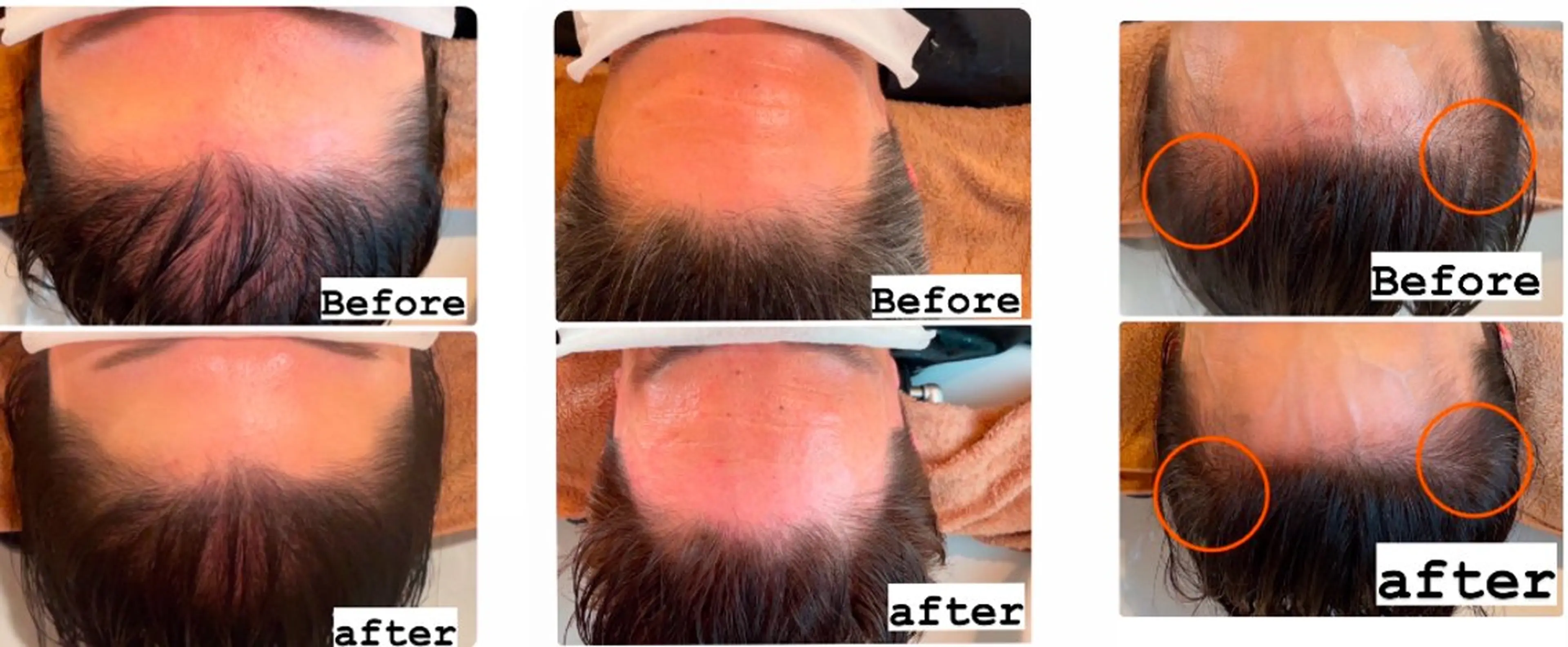 40代ママの 若見え専門美容師のヘアスタイル