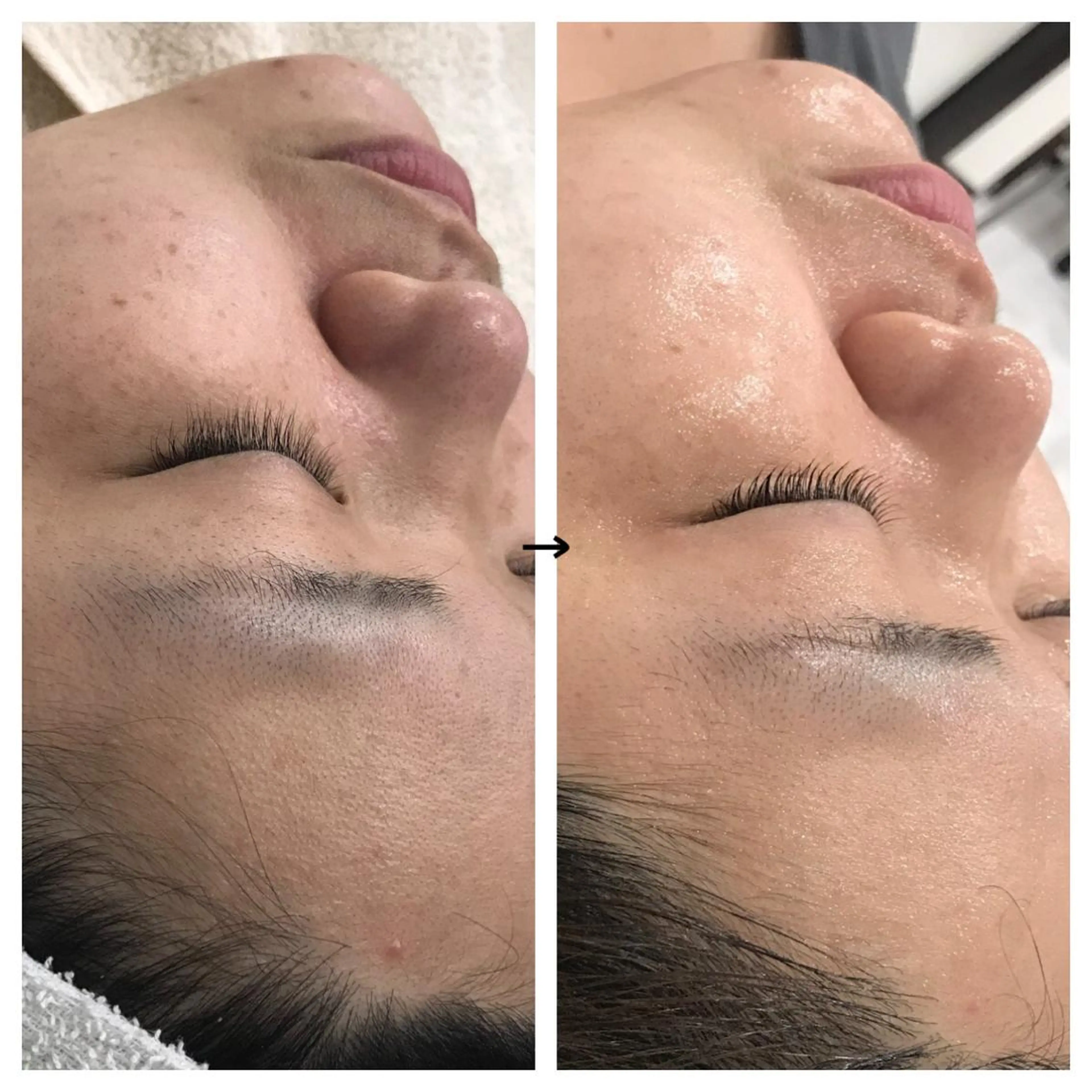 ビューティー ミロワールのエステ・リラクイメージ