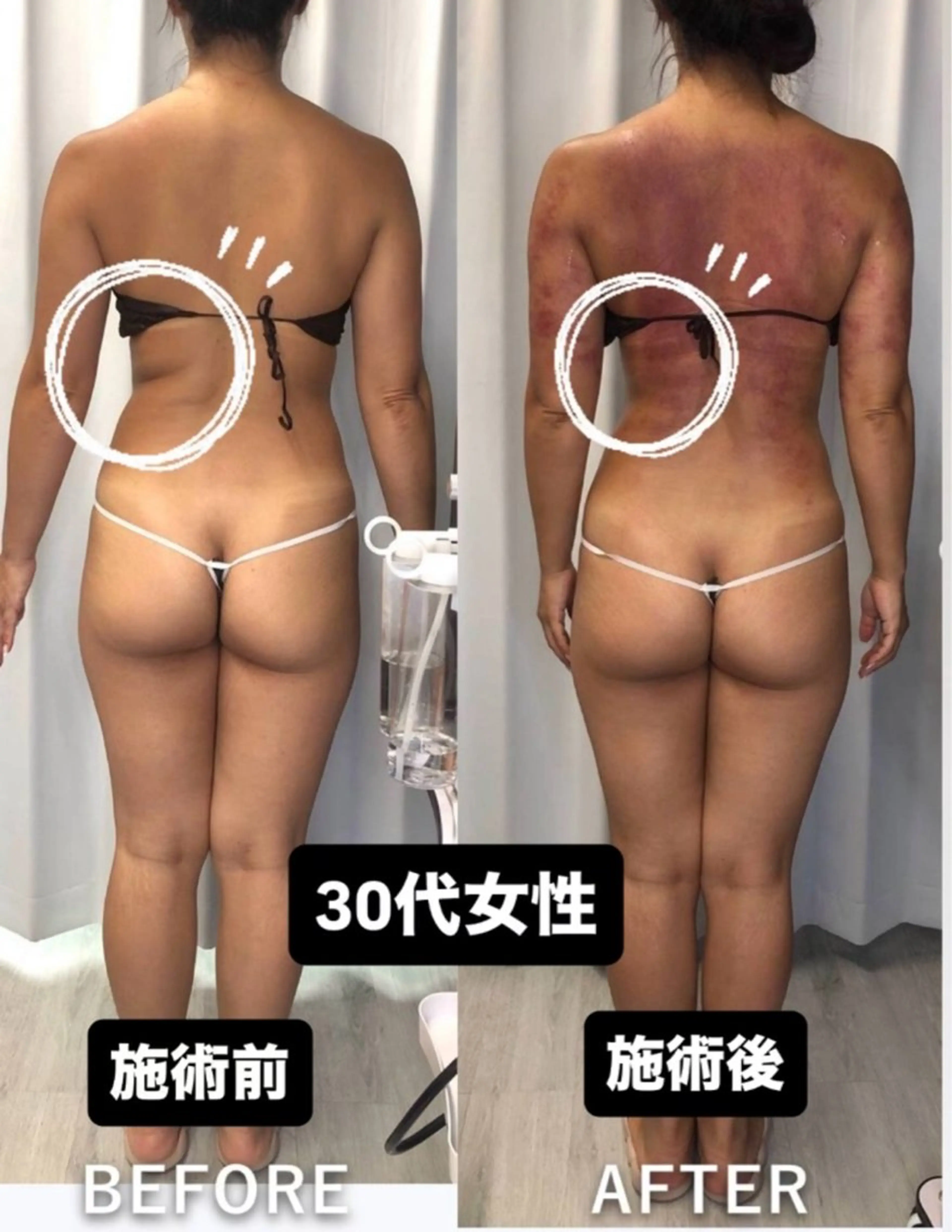 エステ 痩身・脱毛・肌管理 Rechica心斎橋のエステ・リラクイメージ