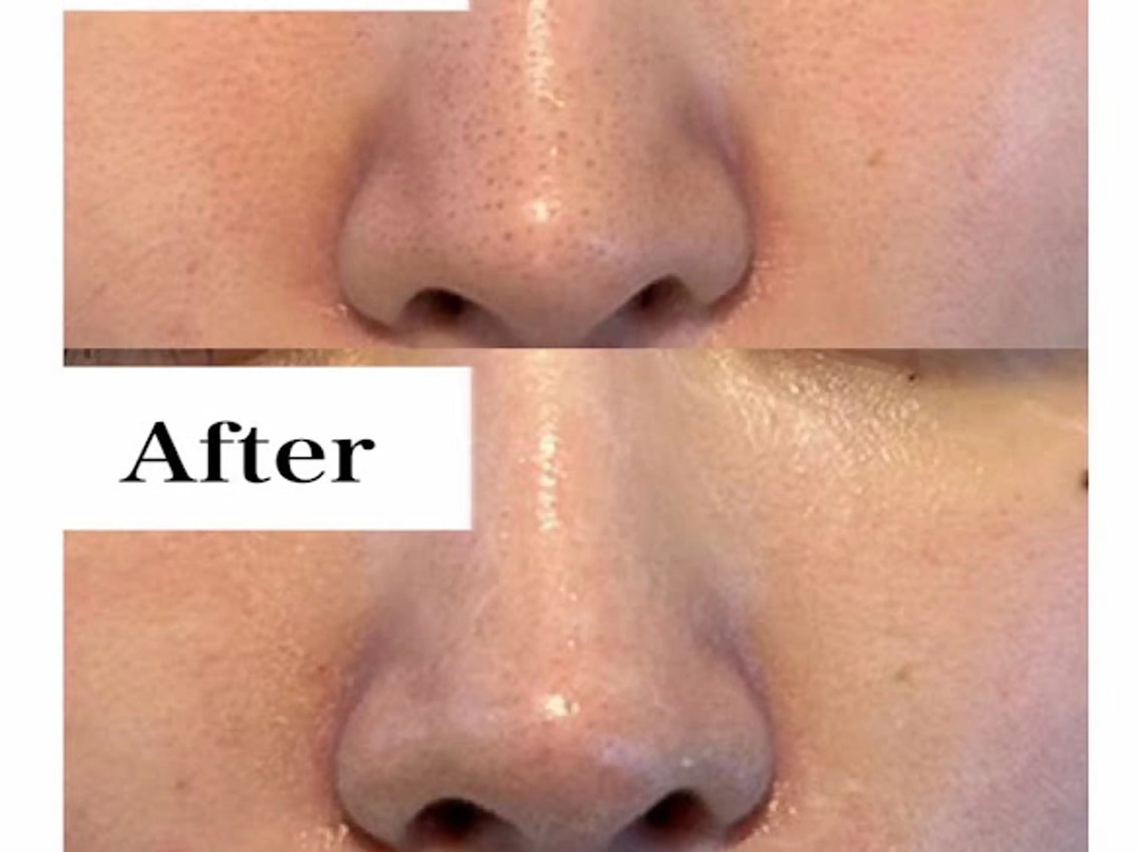 エステ 韓国肌管理Belle 神戸元町のエステ・リラクイメージ