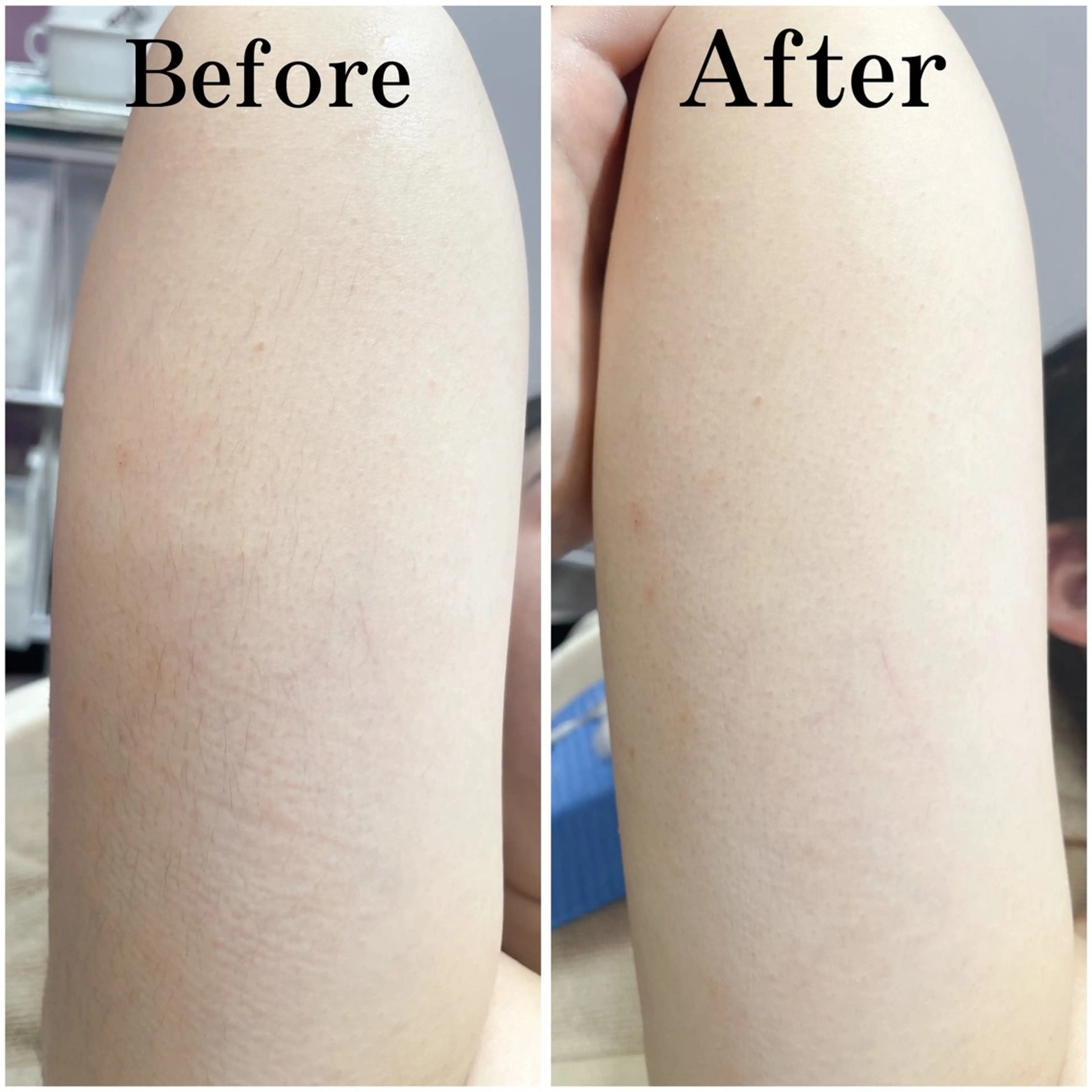 エステ リラク 戸田 麗のその他イメージ