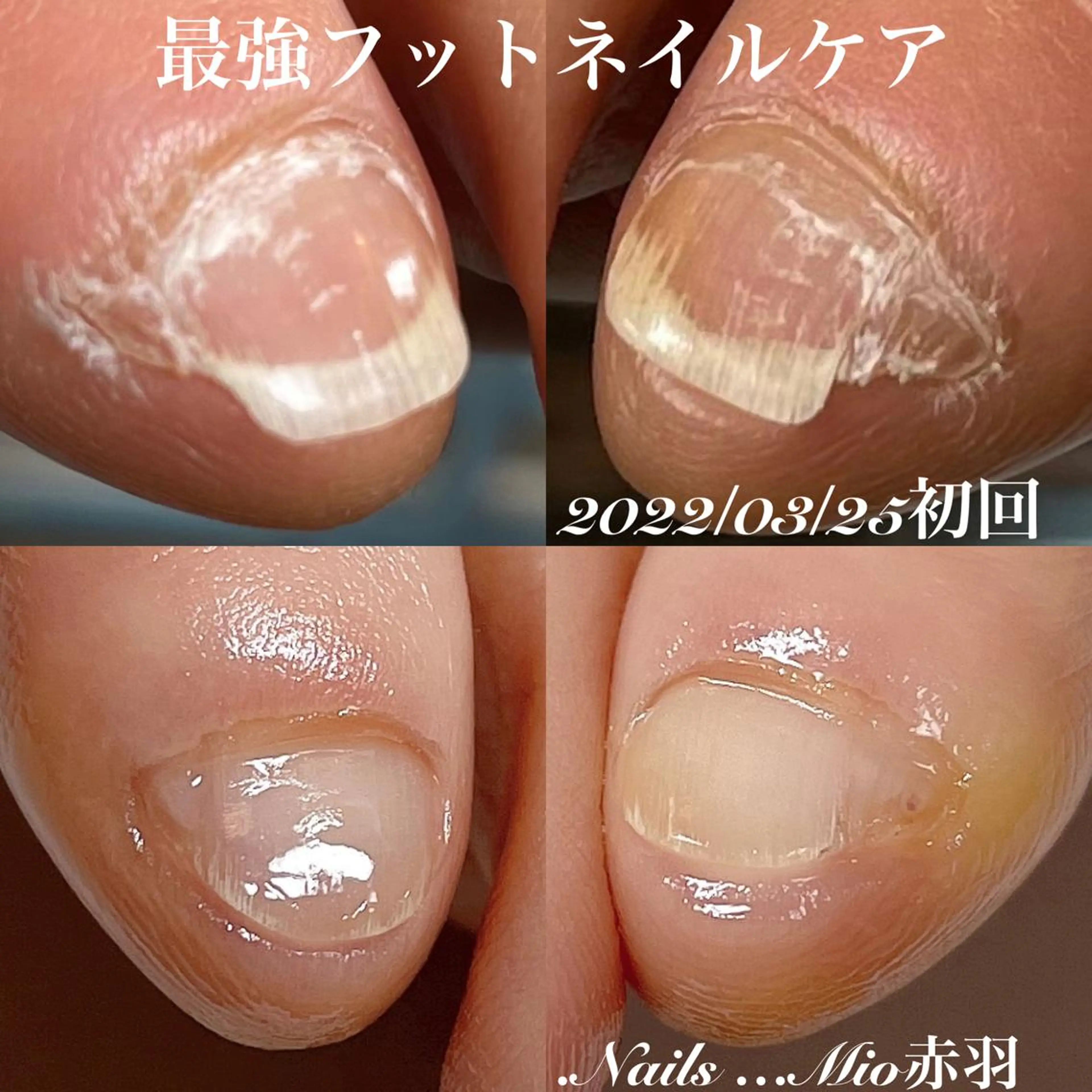 ネイル フットネイル .Nails Mio 赤羽西ネイルサロンのネイルデザイン