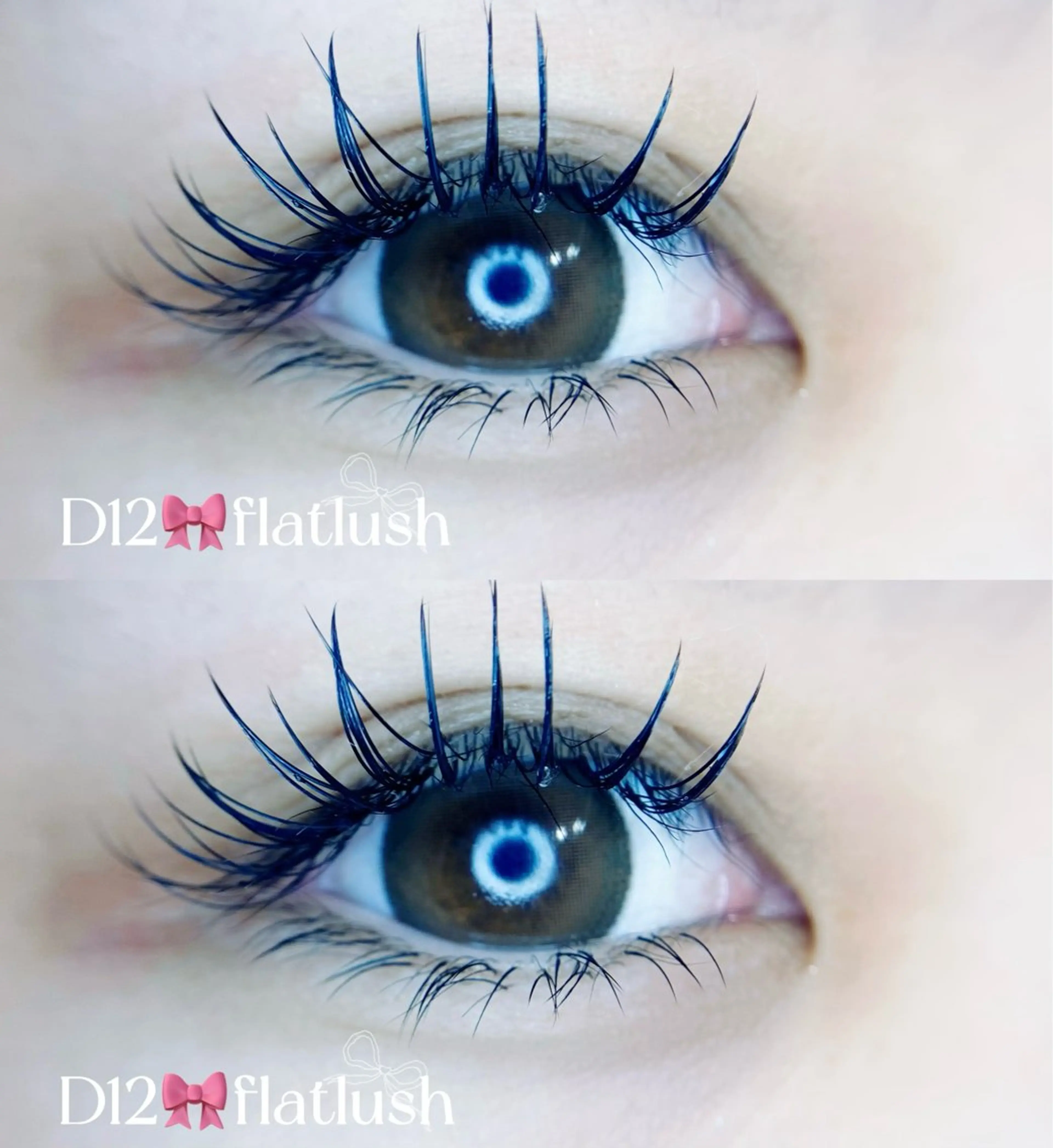 全身脱毛(顔VIO込)💎フラットラッシュ60分付け放題の写真