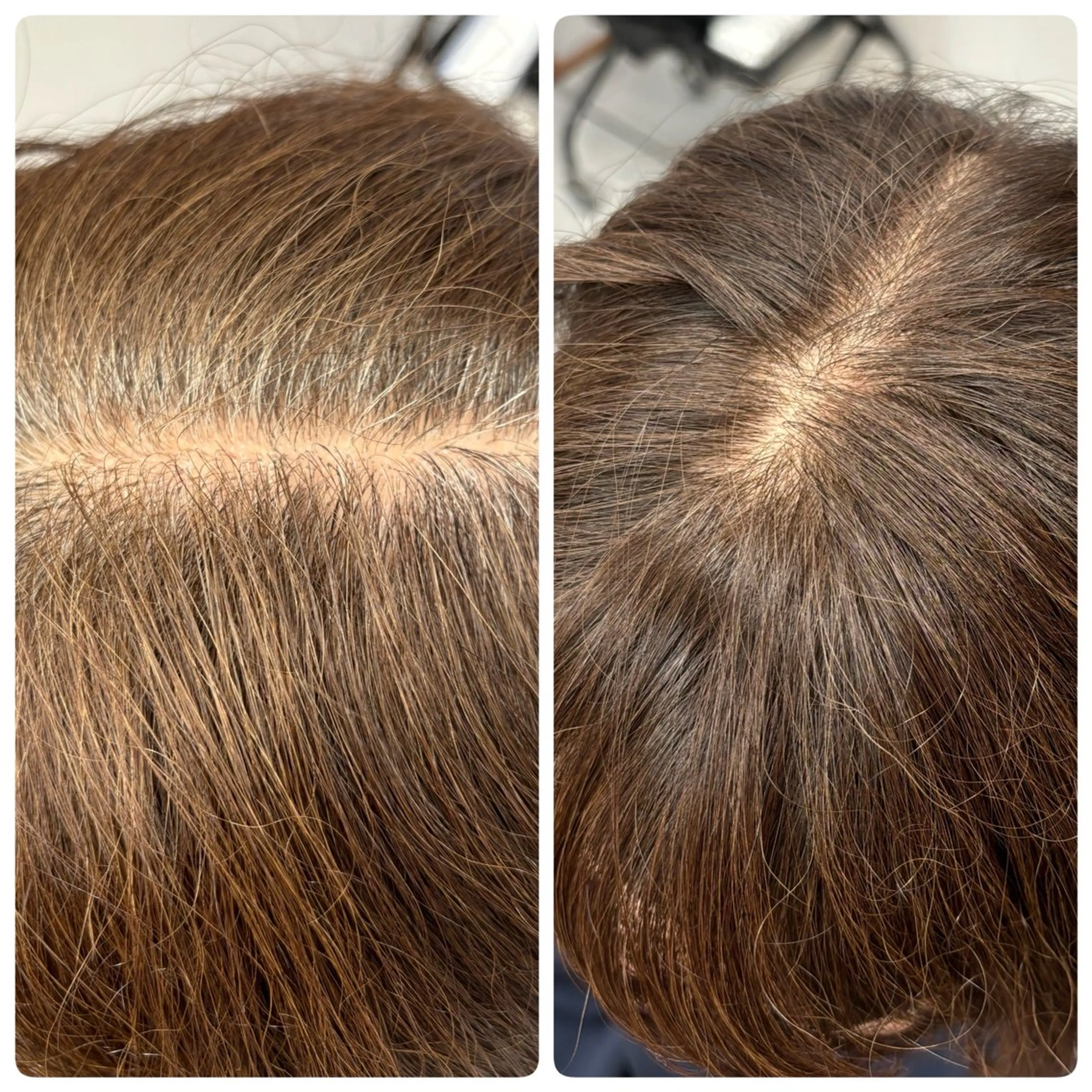 ミディアム ノンジアミンカラー /白髪染め あべのヘアスタイル