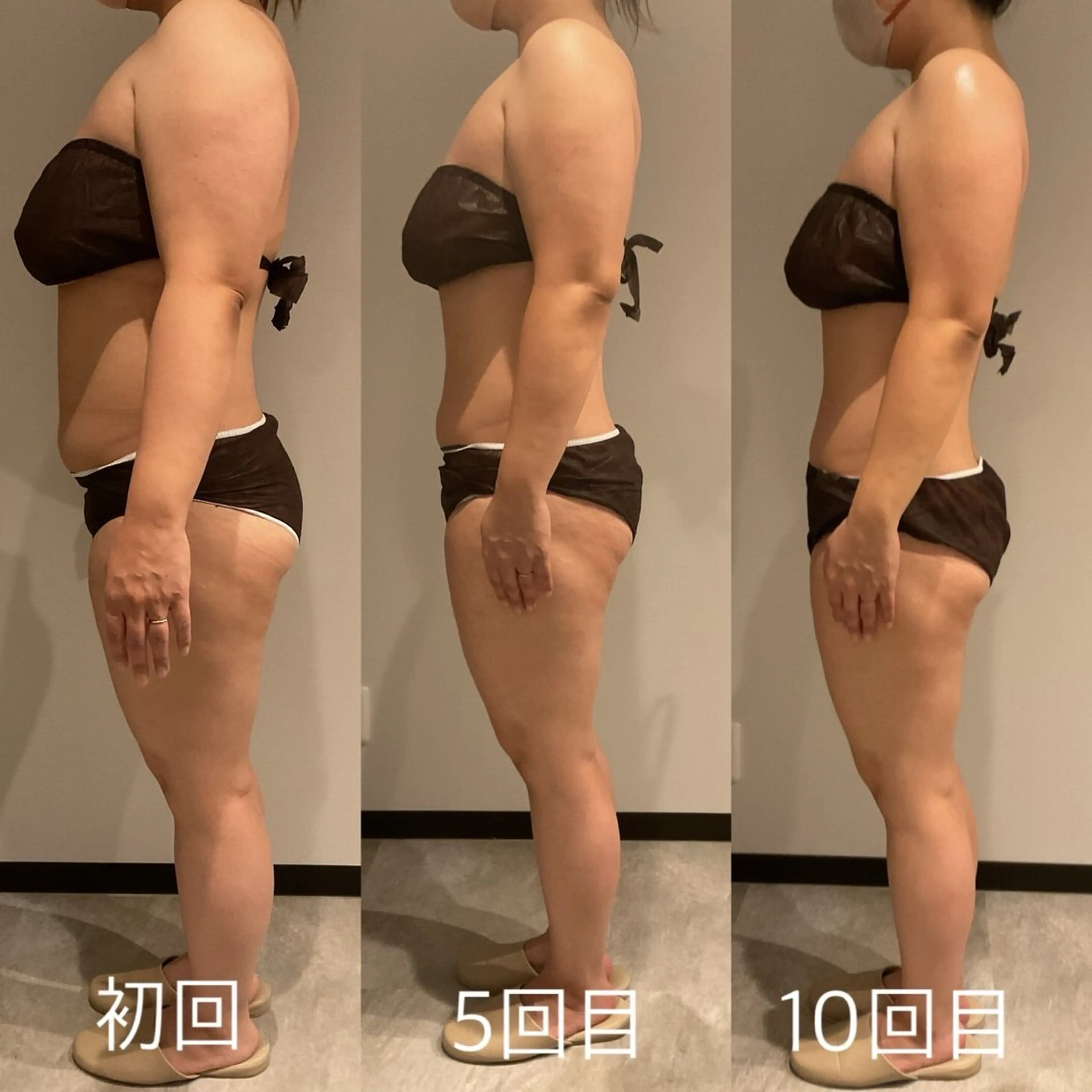 エステ リラク Esthetic MiEUXのエステ・リラクイメージ