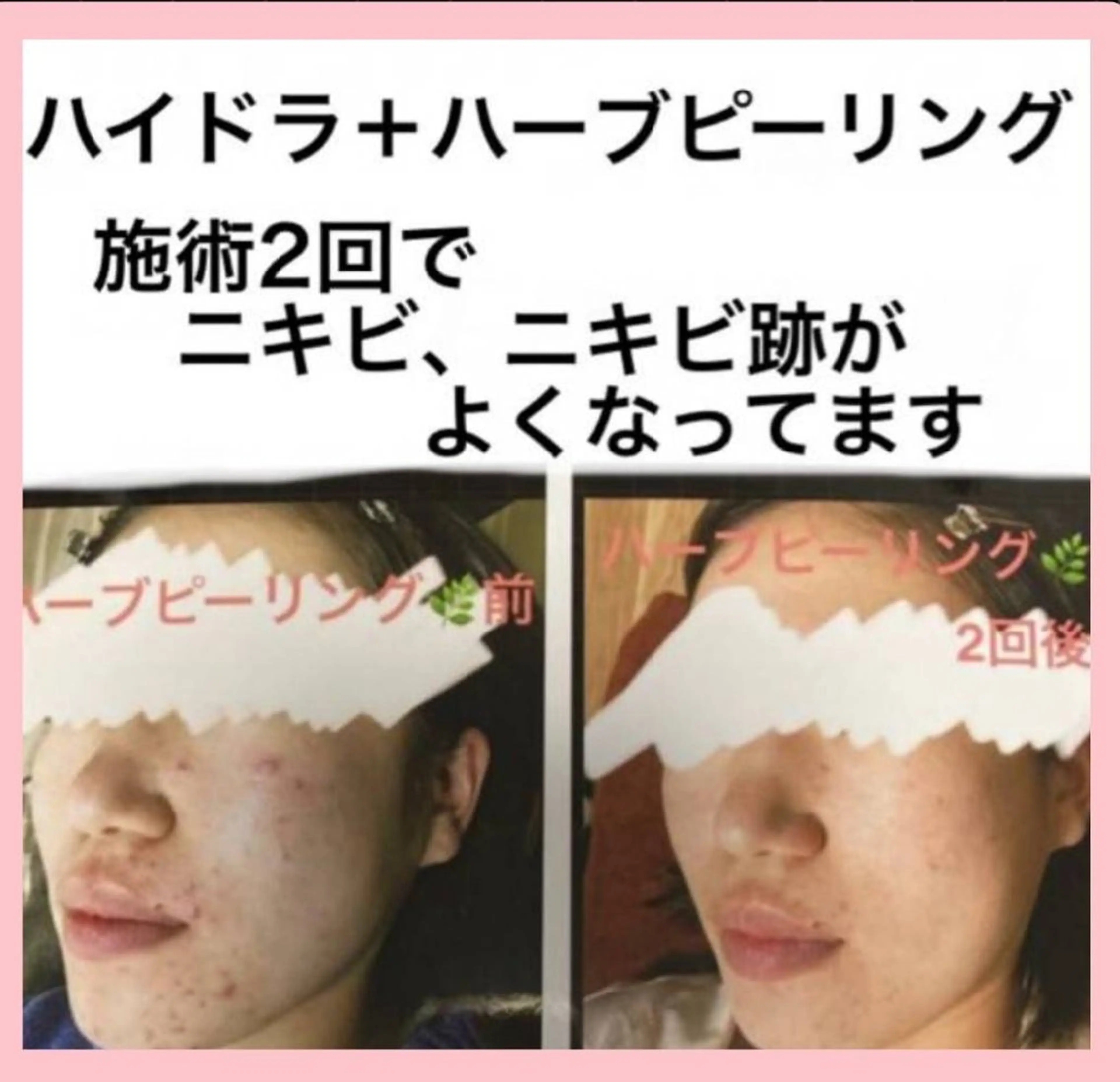 エステ ハーブピーリング 専門店Kikkaのエステ・リラクイメージ