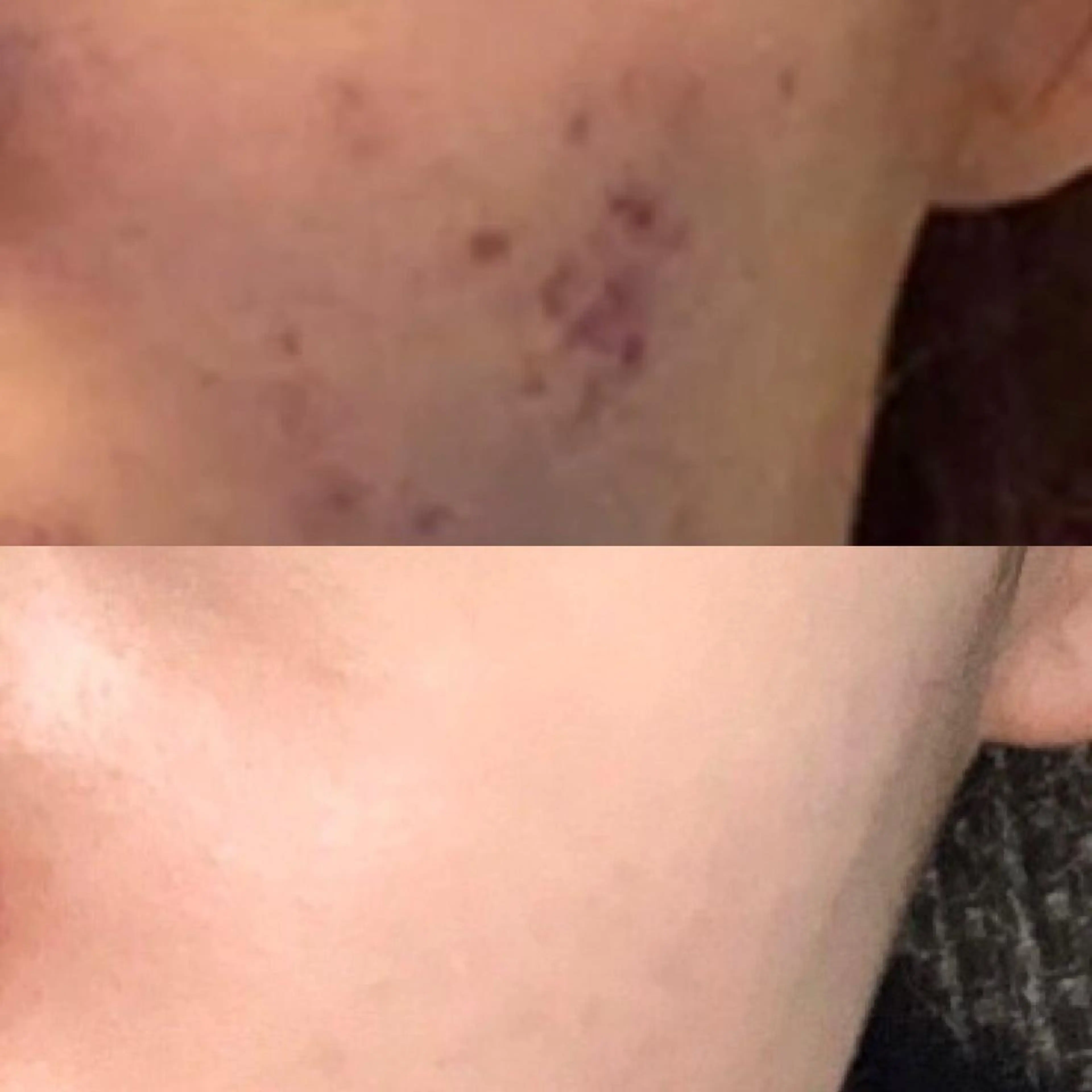 メンズ 朝重い人専用 肩甲骨調整のエステ・リラクイメージ