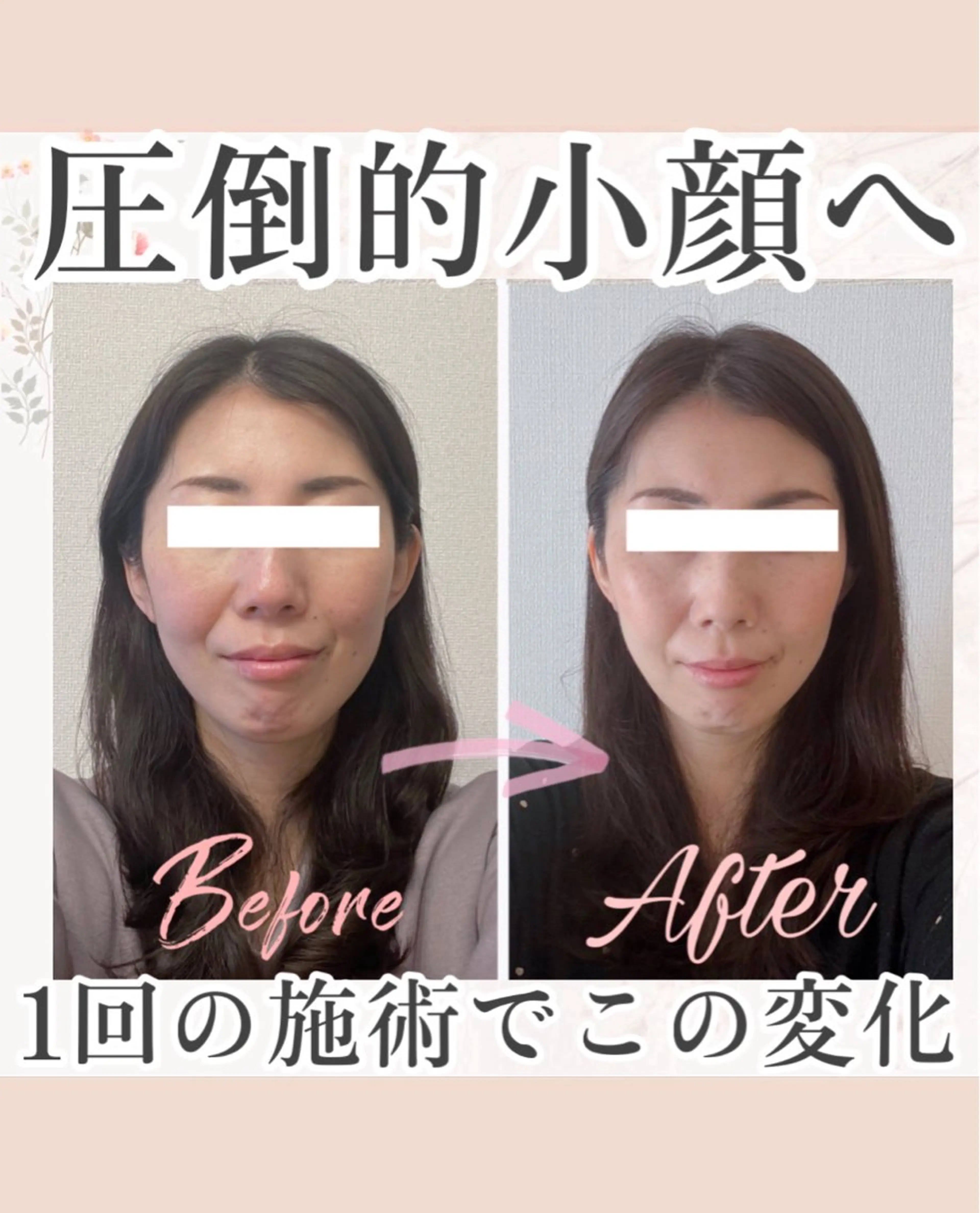 小顔矯正専門サロンAxiune所属・小顔矯正専門 🪽アシュネ平野のエステ・リラクイメージ