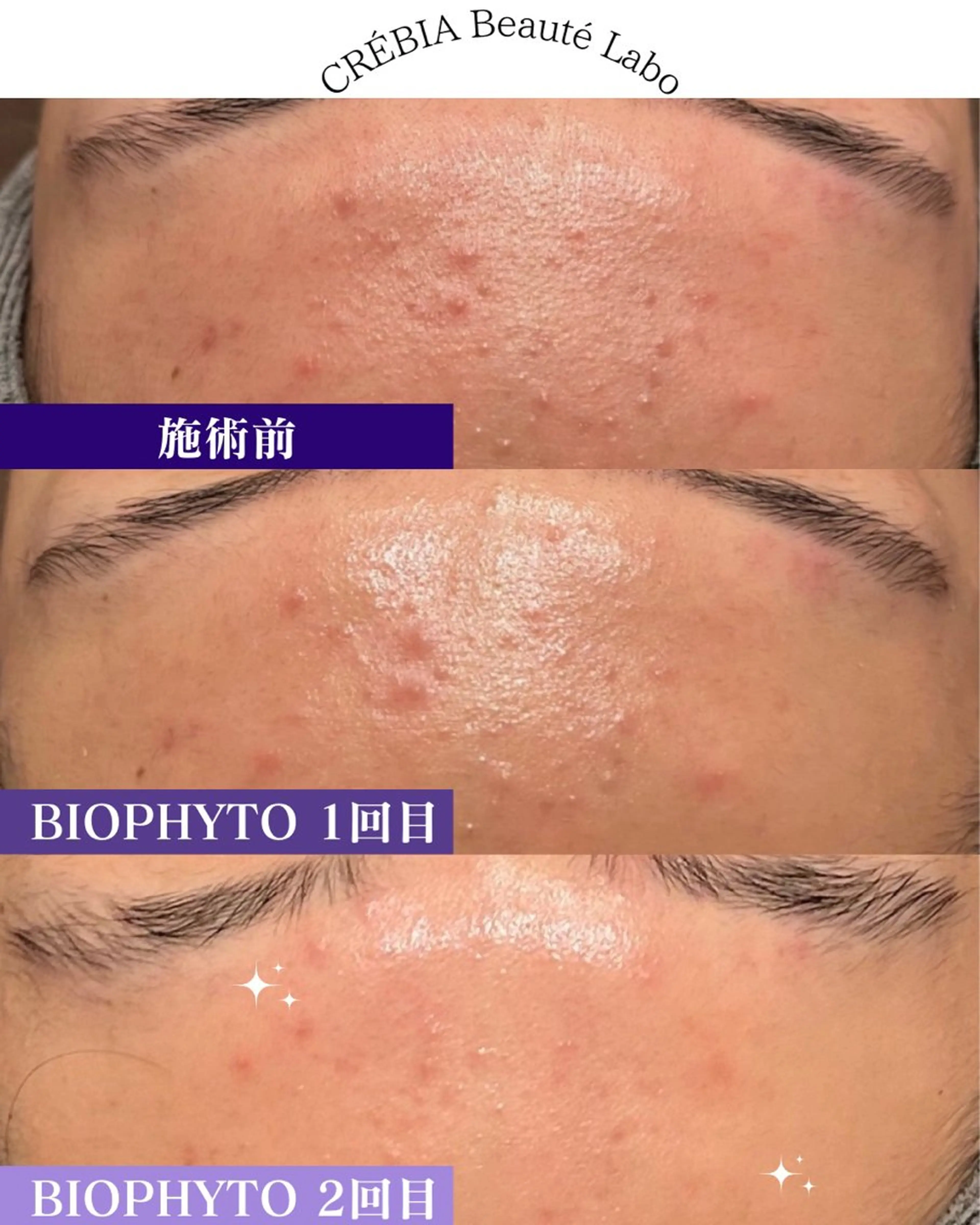 エステ 小顔＆まつ毛サロン AKANE❤️のエステ・リラクイメージ