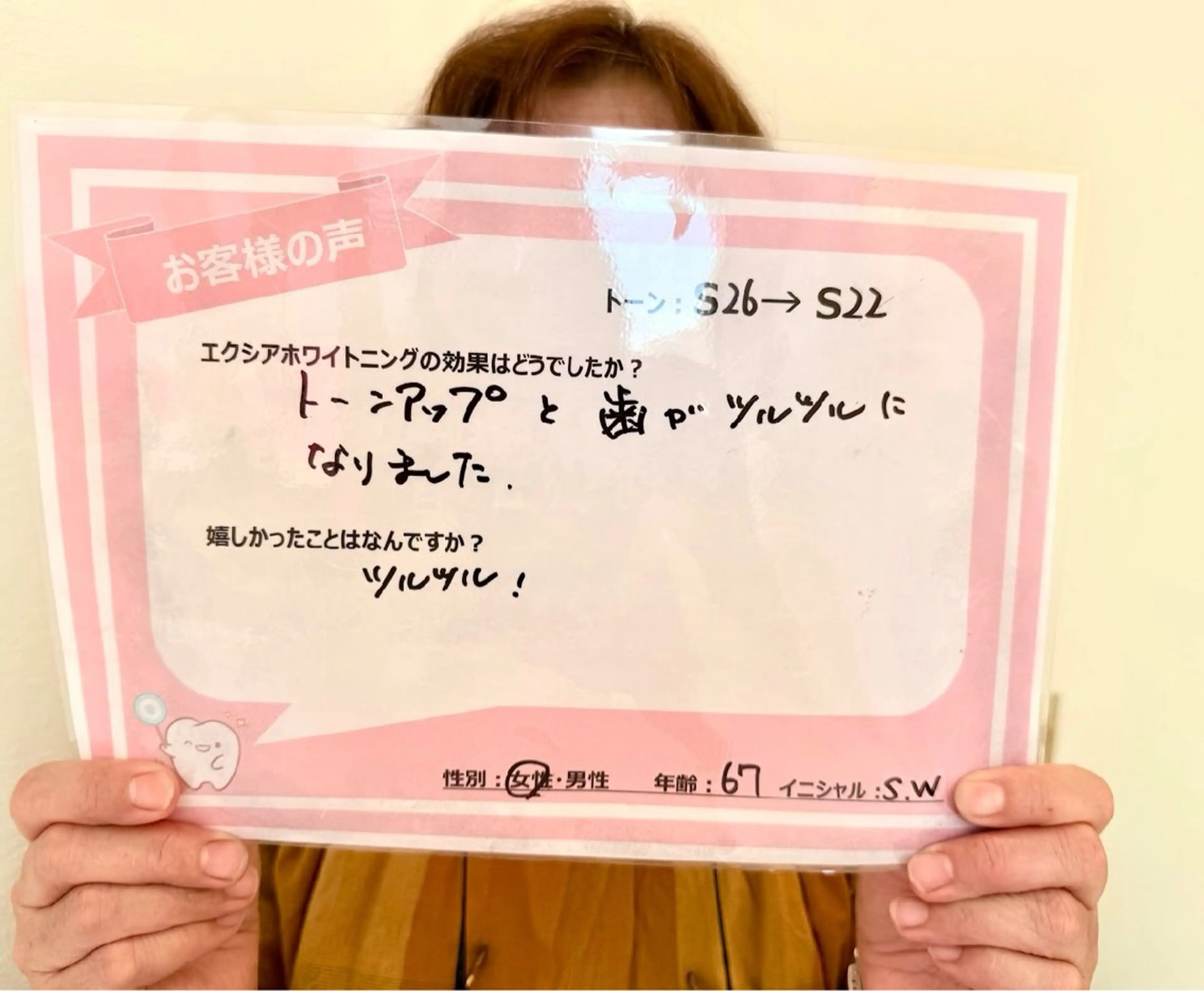 セルフホワイトニング エクシアエミフル店のその他イメージ