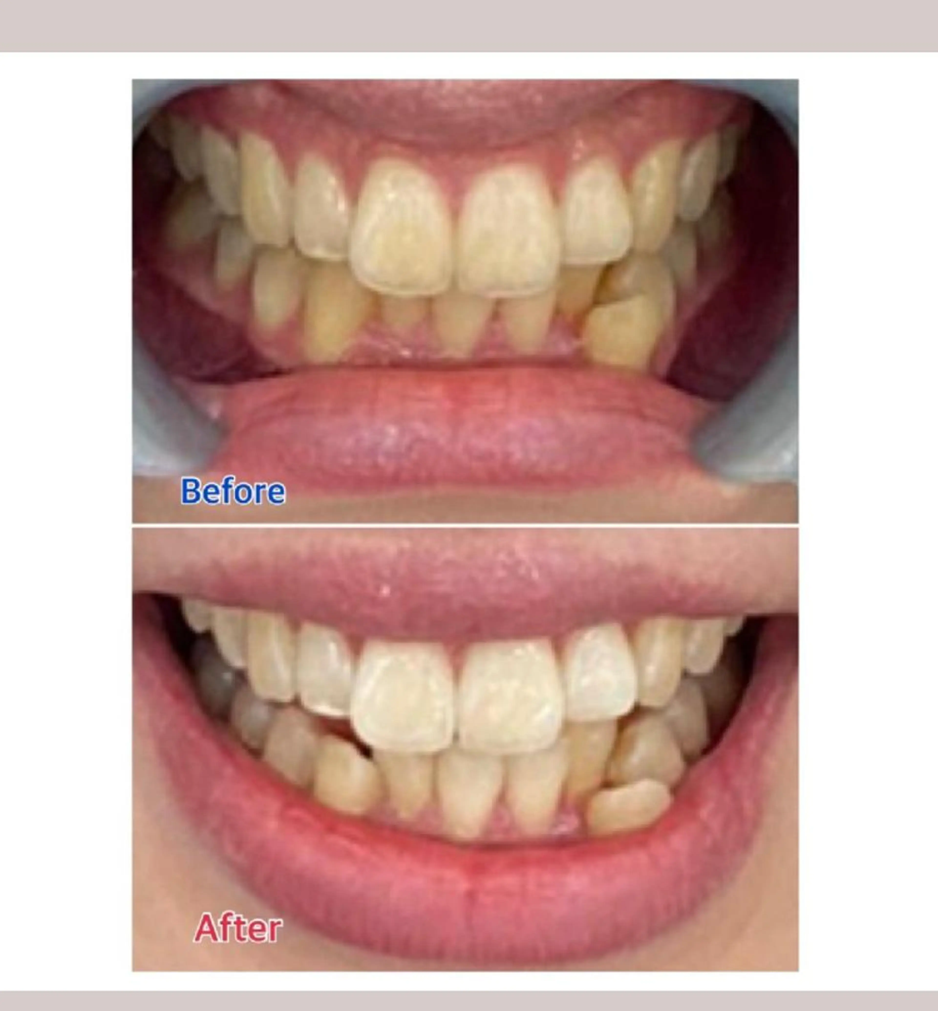 M渋谷 ホワイトニングのエステ・リラクイメージ