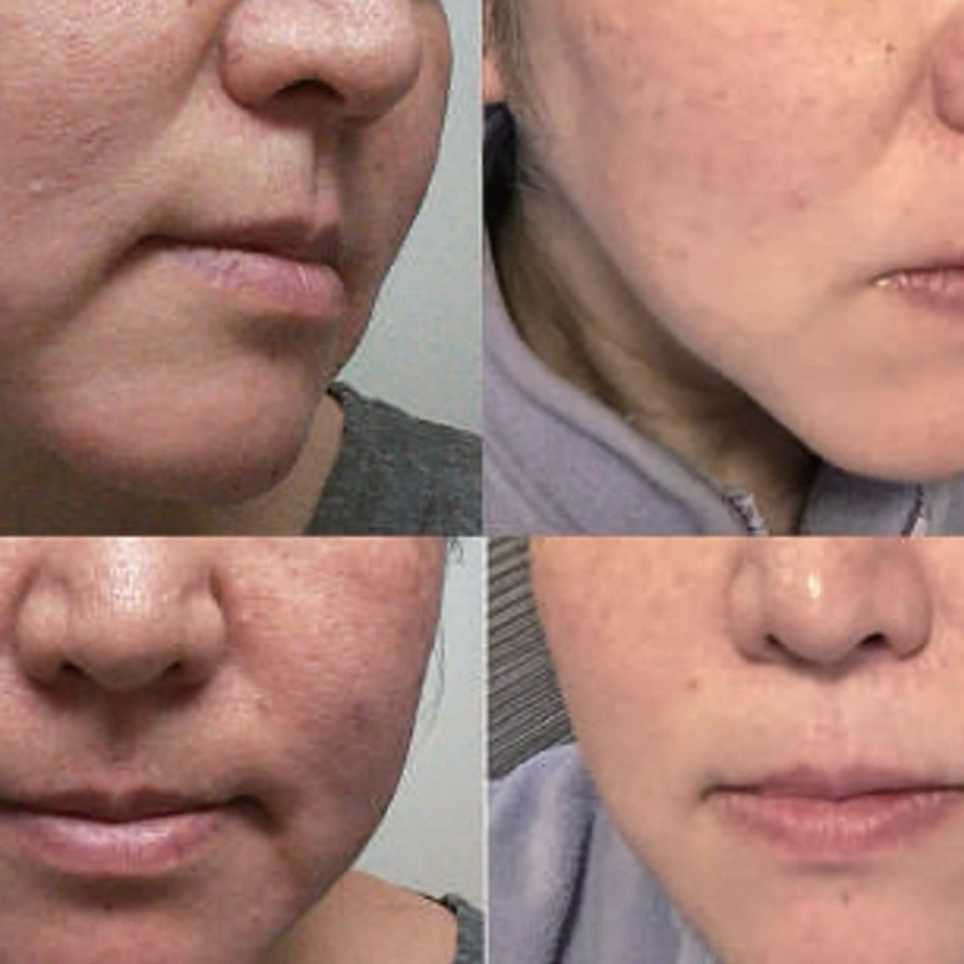 エステ 美肌蘇生カウンセラー 横山りえのエステ・リラクイメージ