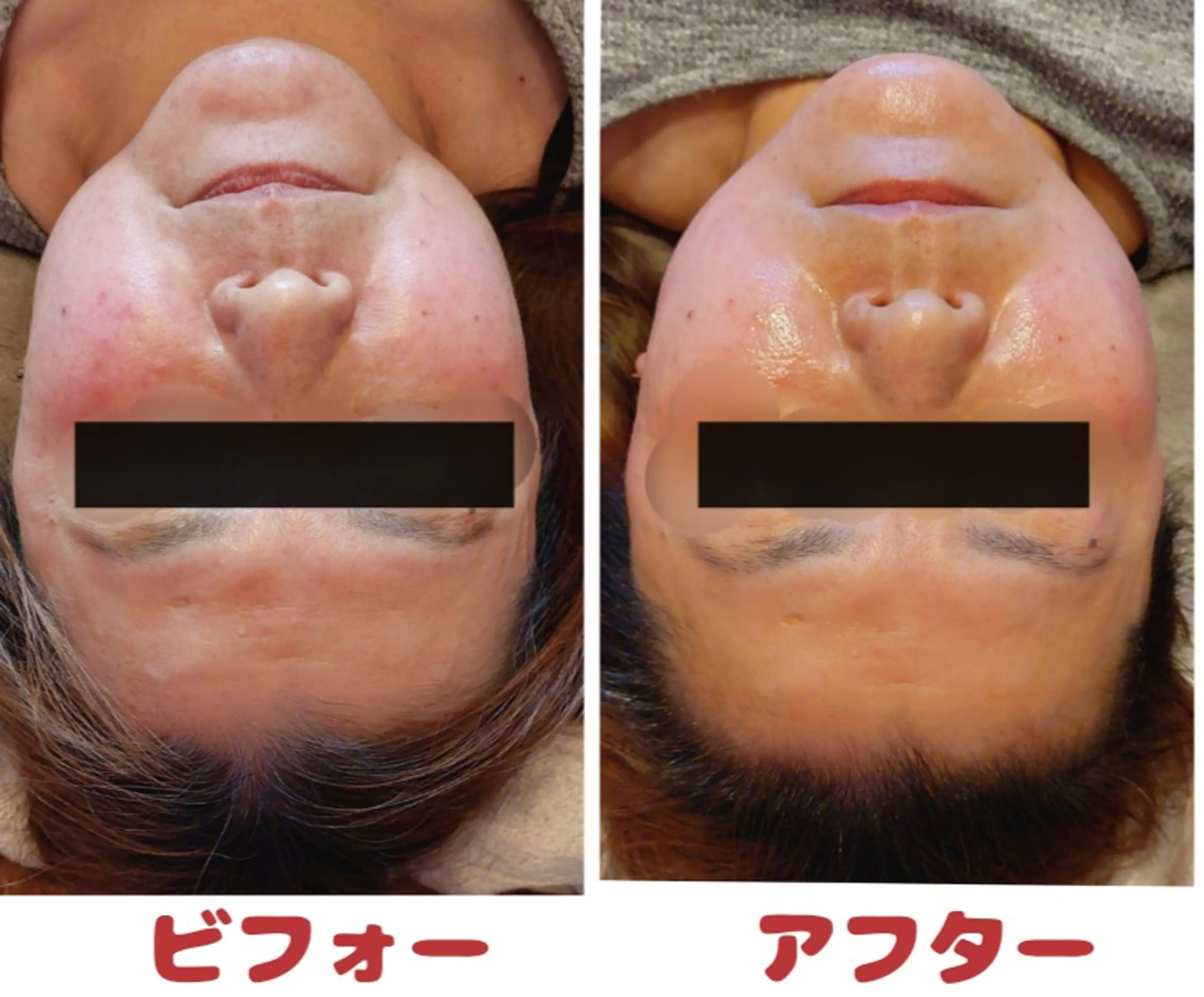 EL.ALLY イーエル.アリーのエステ・リラクイメージ