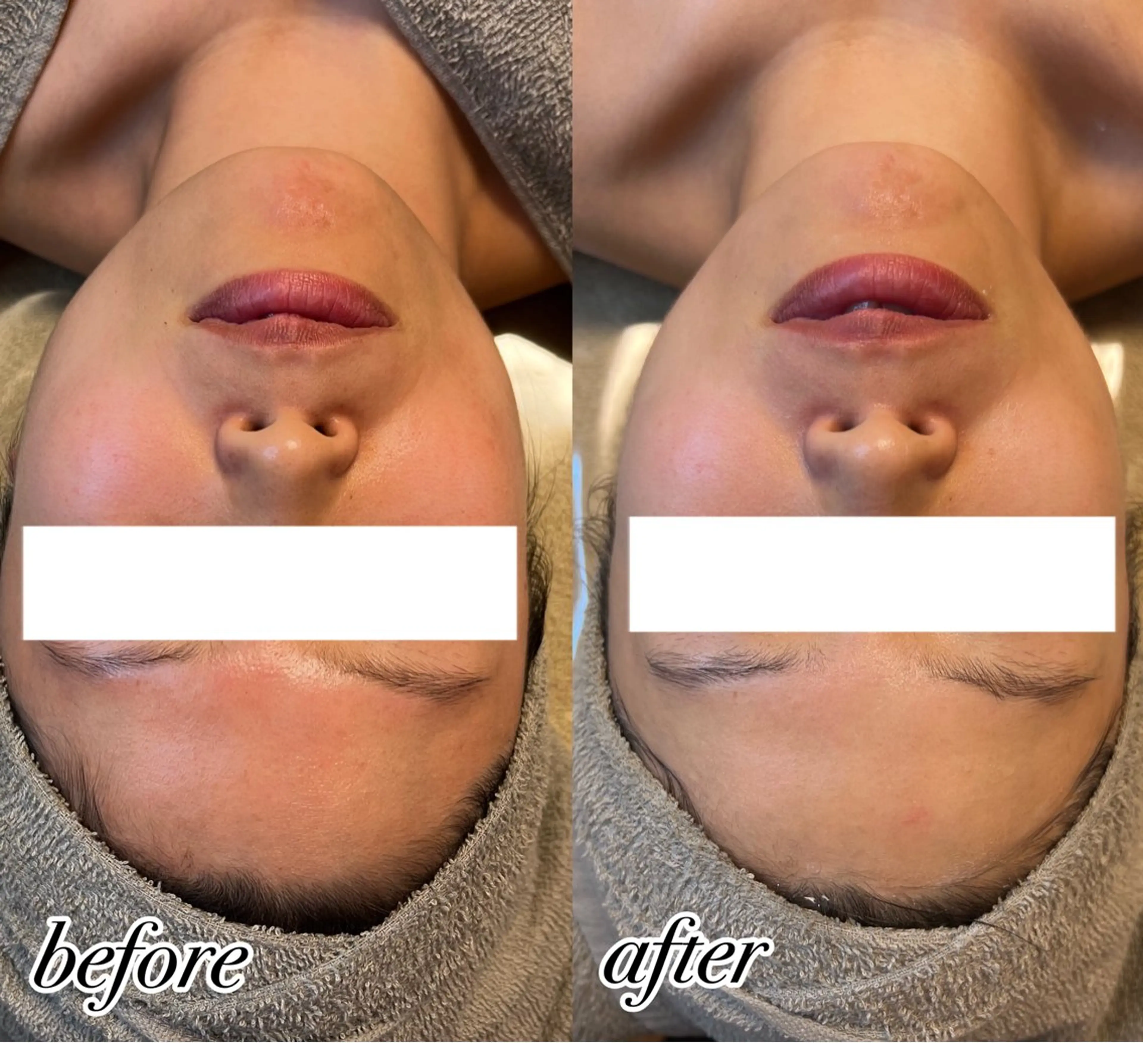 筋膜リリースコース🫧の写真