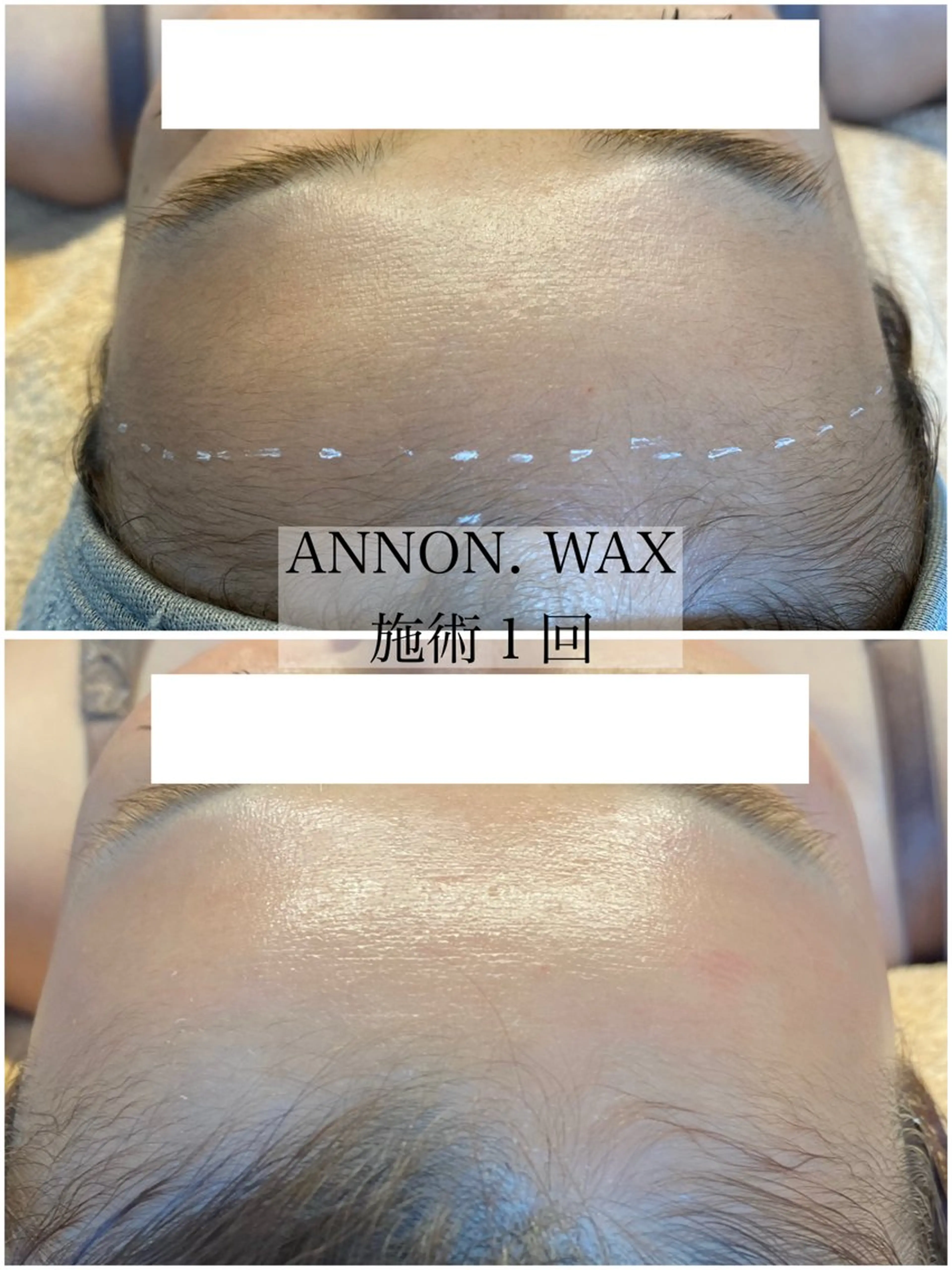 エステ 肌質改善ワックス専門 yukiのエステ・リラクイメージ