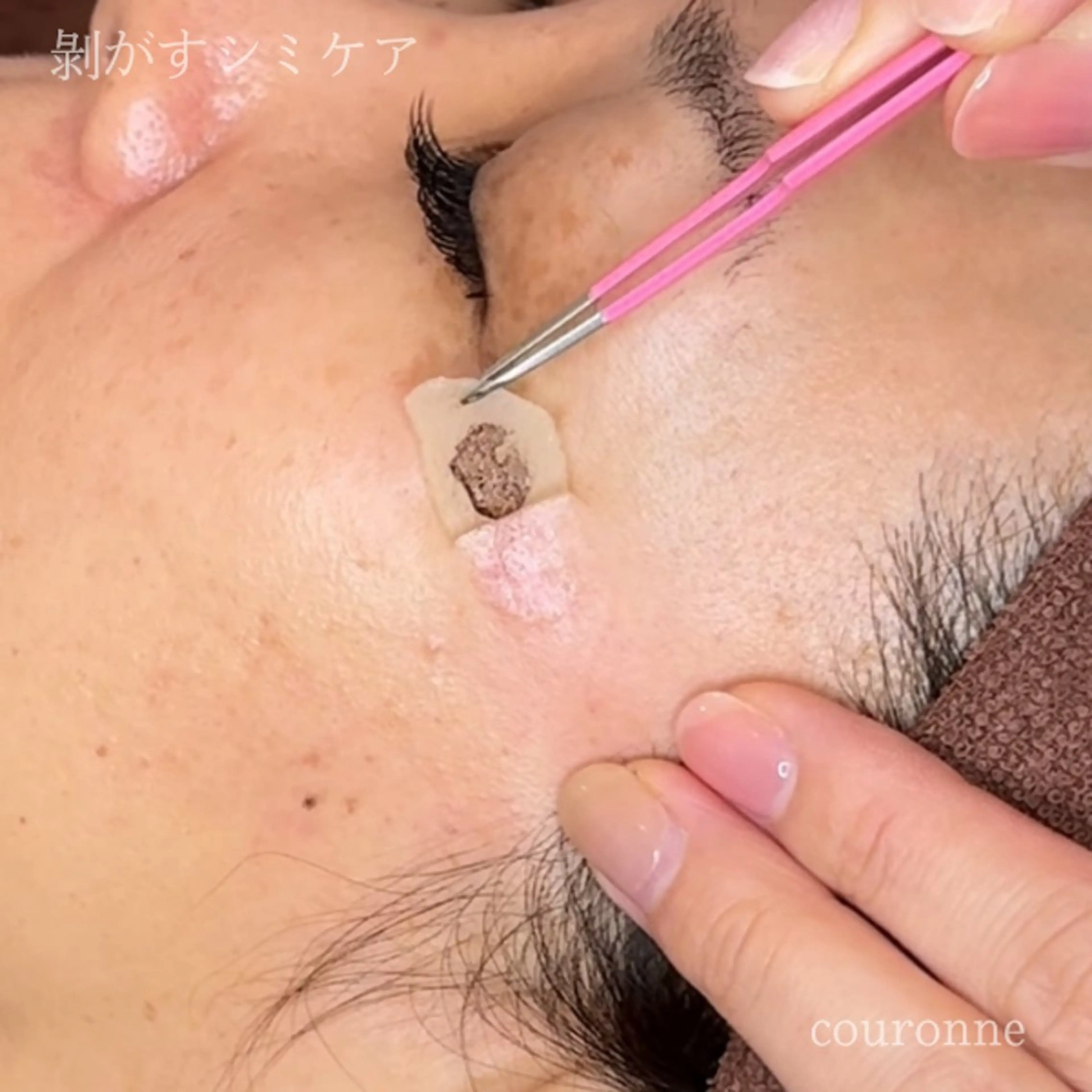 エステ シミ・毛穴ケア専門 クロヌYUKIのエステ・リラクイメージ