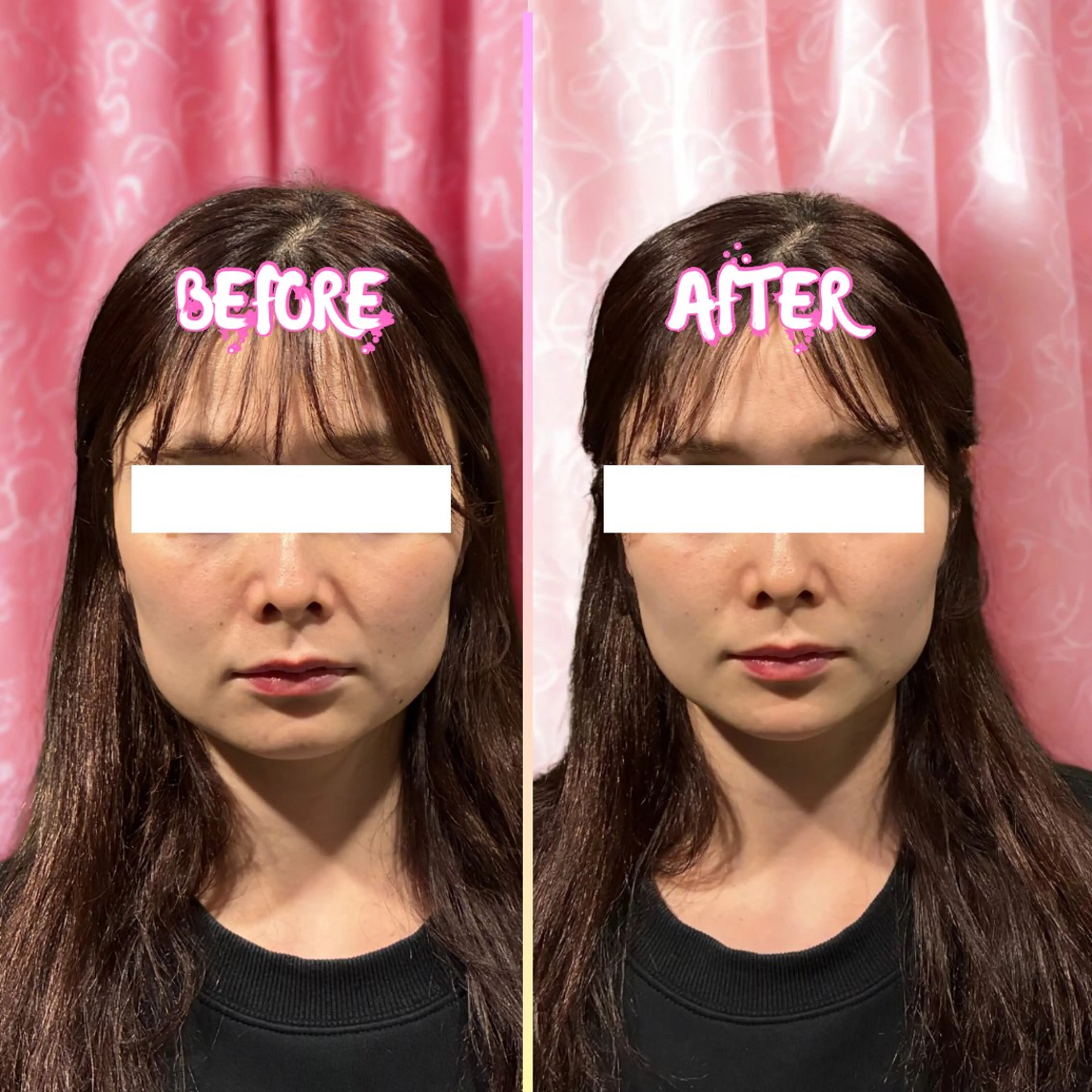 輝くドレス姿に導く ブライダルミッキーのエステ・リラクイメージ