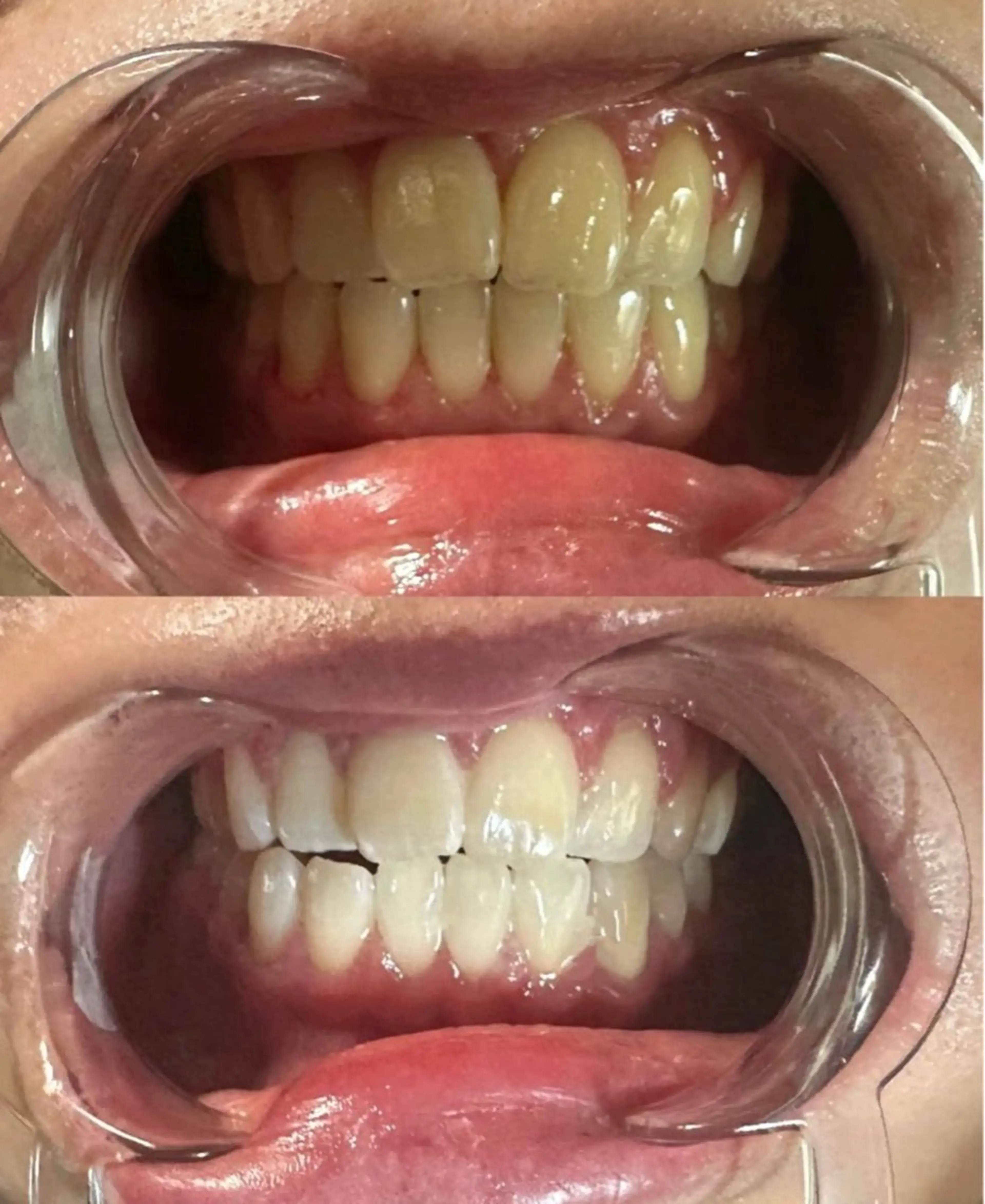 YuA beauty所属・YuA beautyのマツエク・マツパデザイン