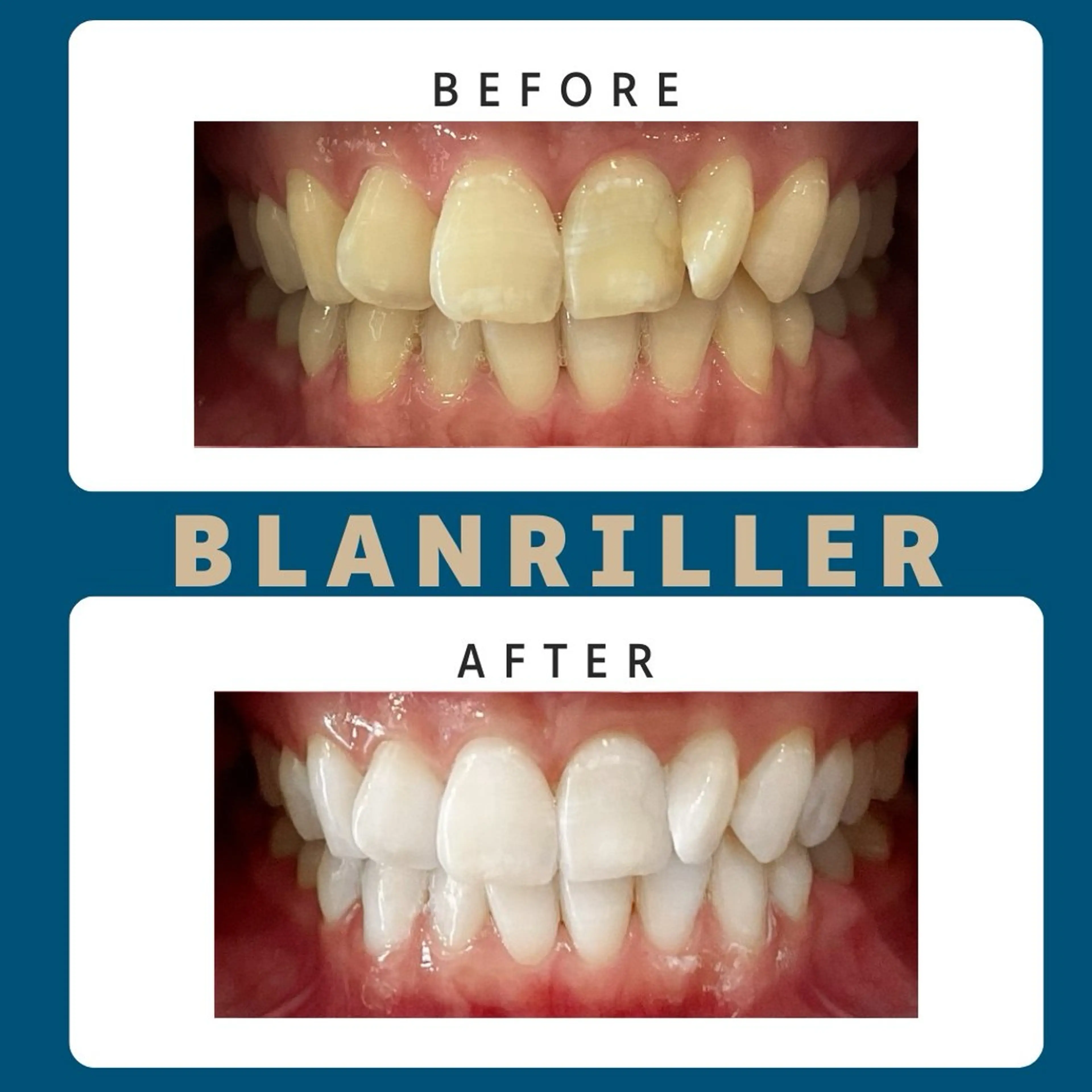 その他 BLANRILLER所属・ホワイトニングサロン ブランリエ阿倍野店のその他イメージ