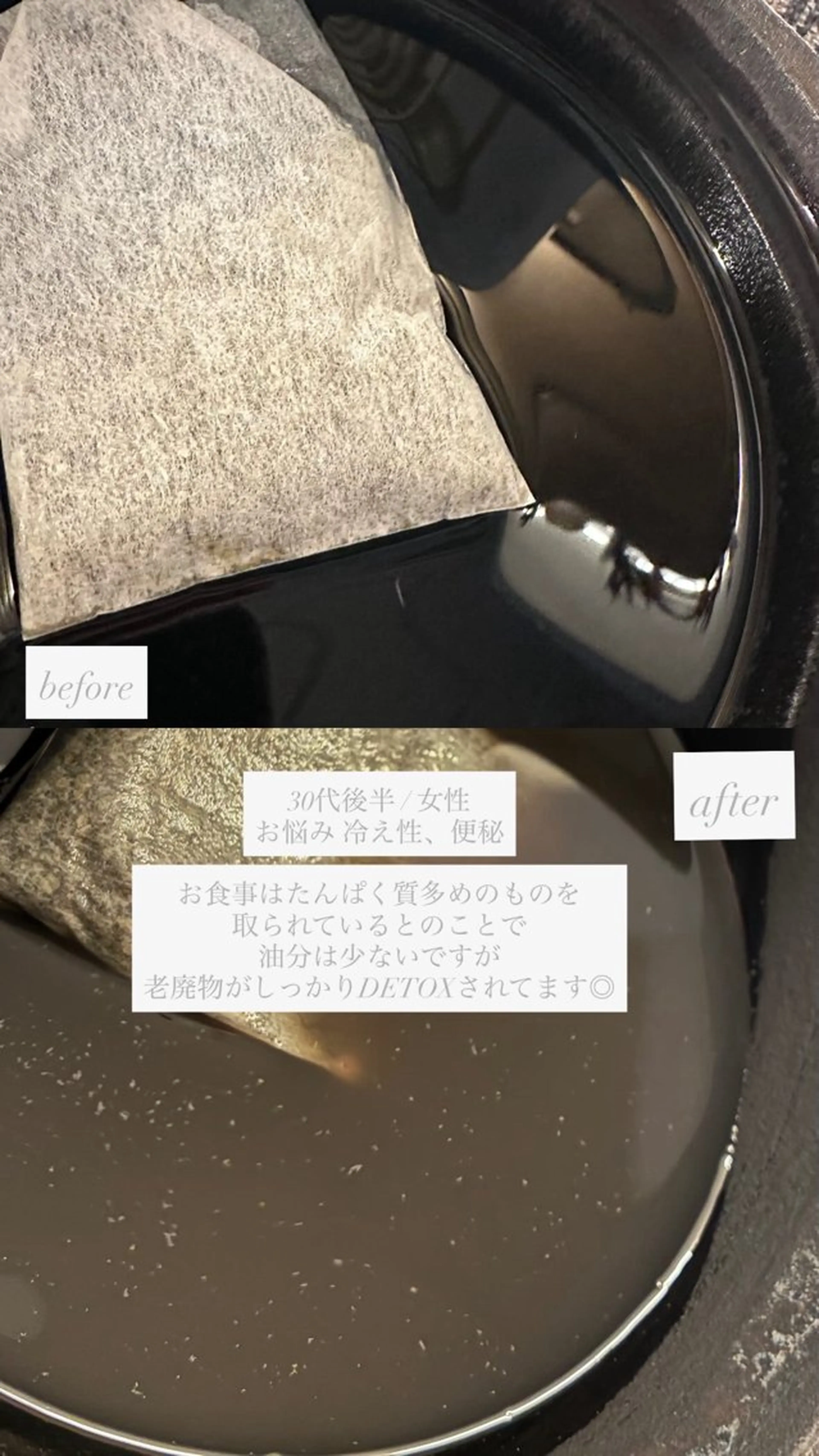 chouchou【シュシュ】所属・トータルボディケア chouchouのエステ・リラクイメージ