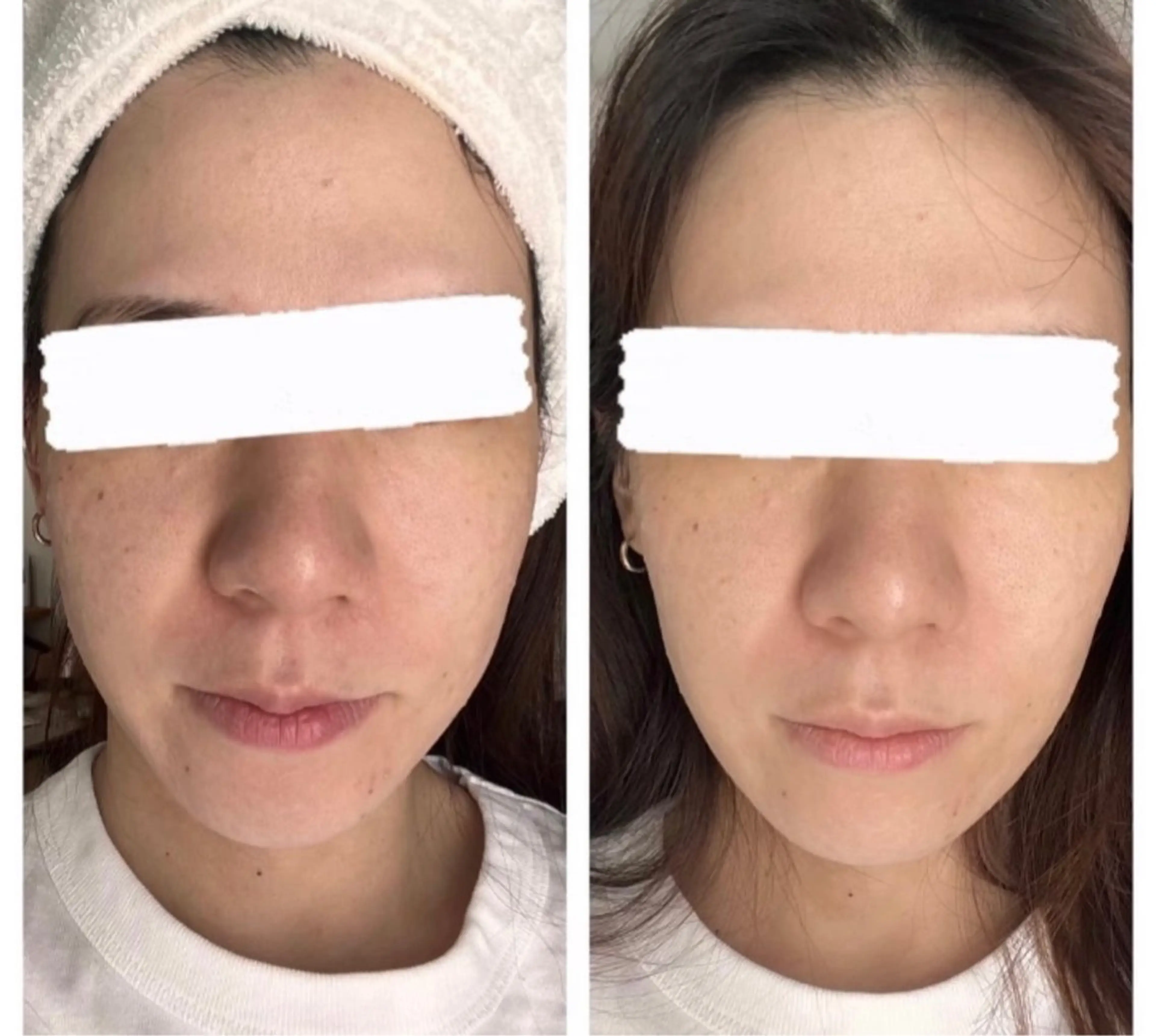 ヒト幹細胞導入コースの写真