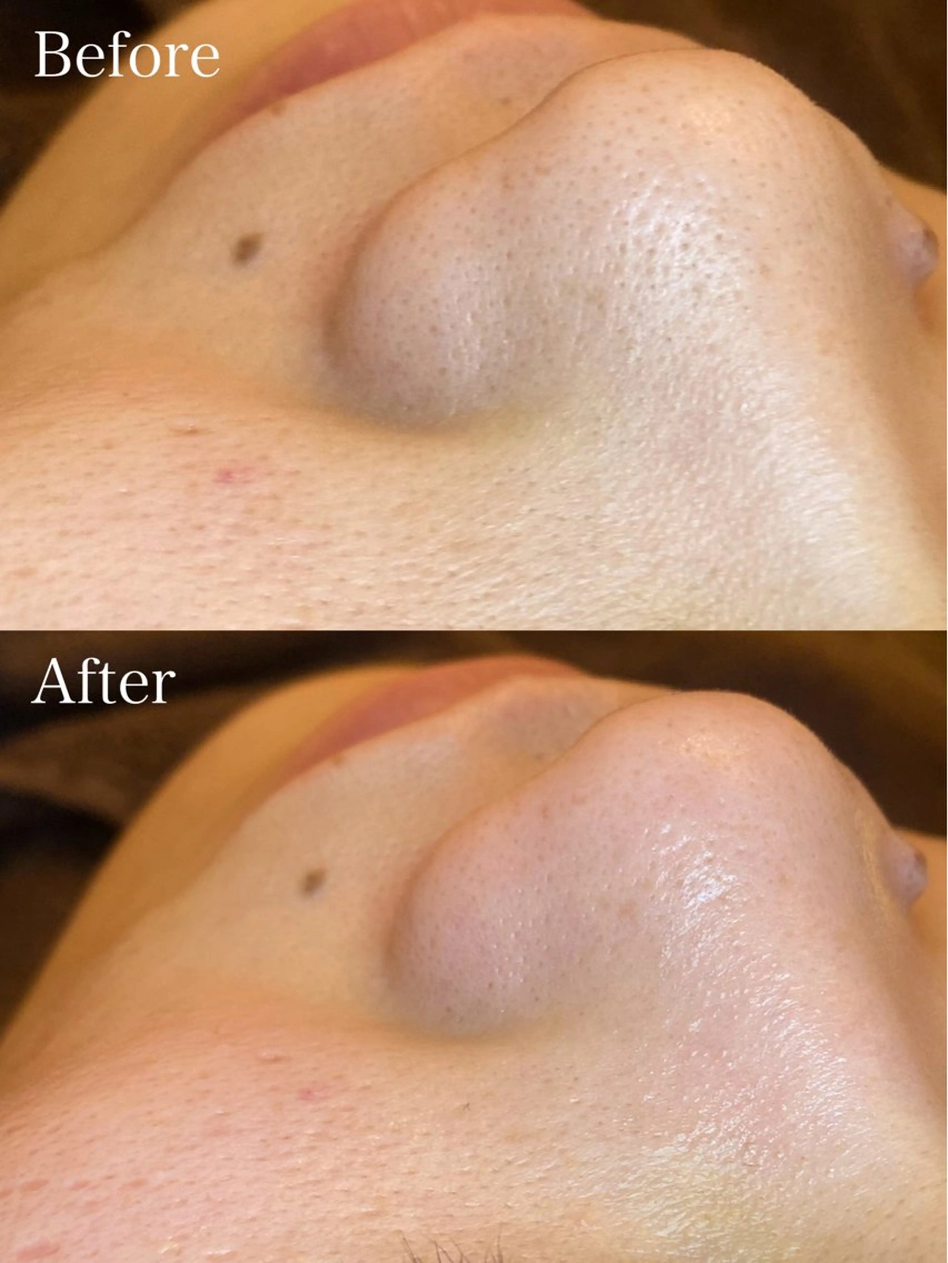 🤍アベシュリ /フェイシャル🤍のエステ・リラクイメージ