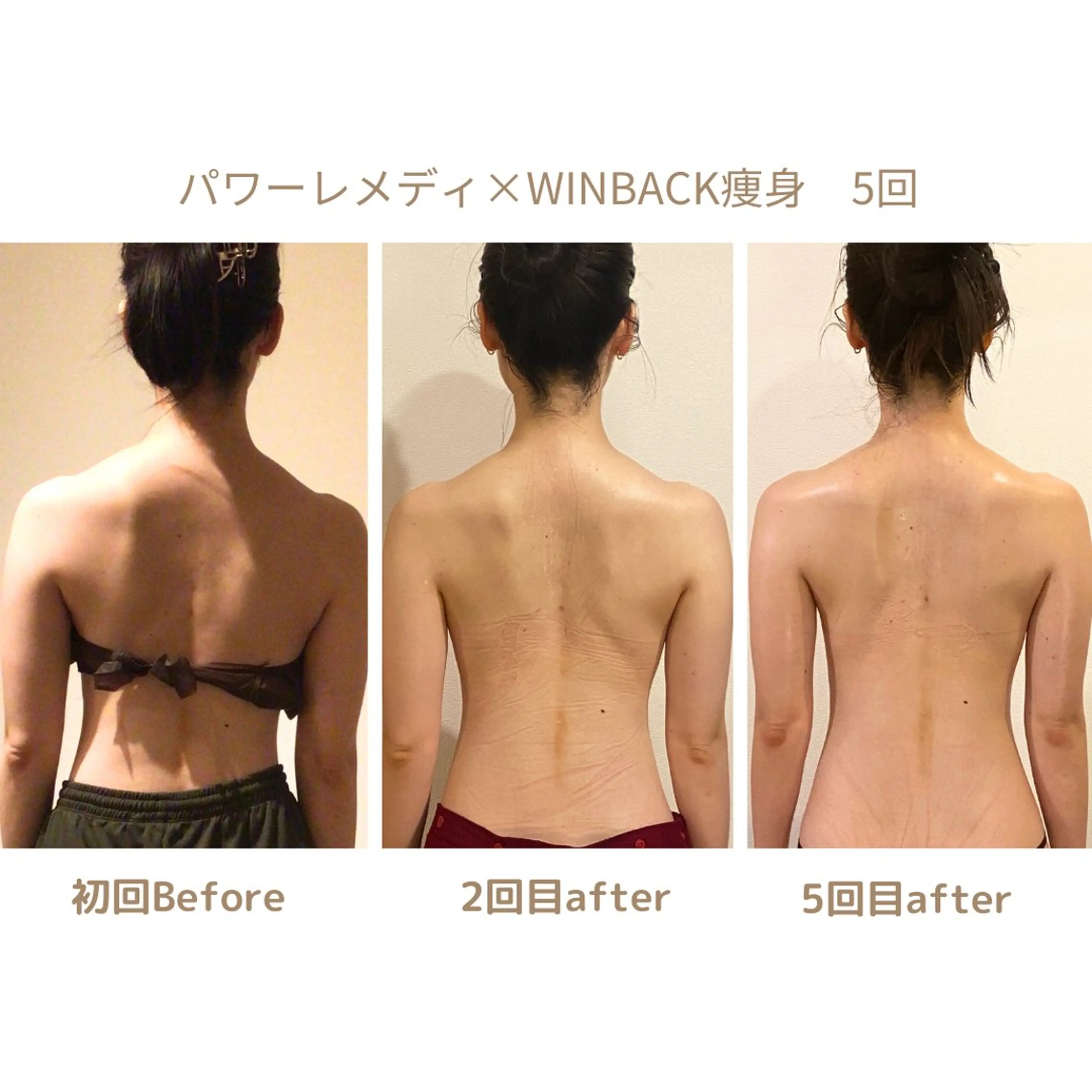 肌質改善×小顔サロン リトリト垣内のエステ・リラクイメージ