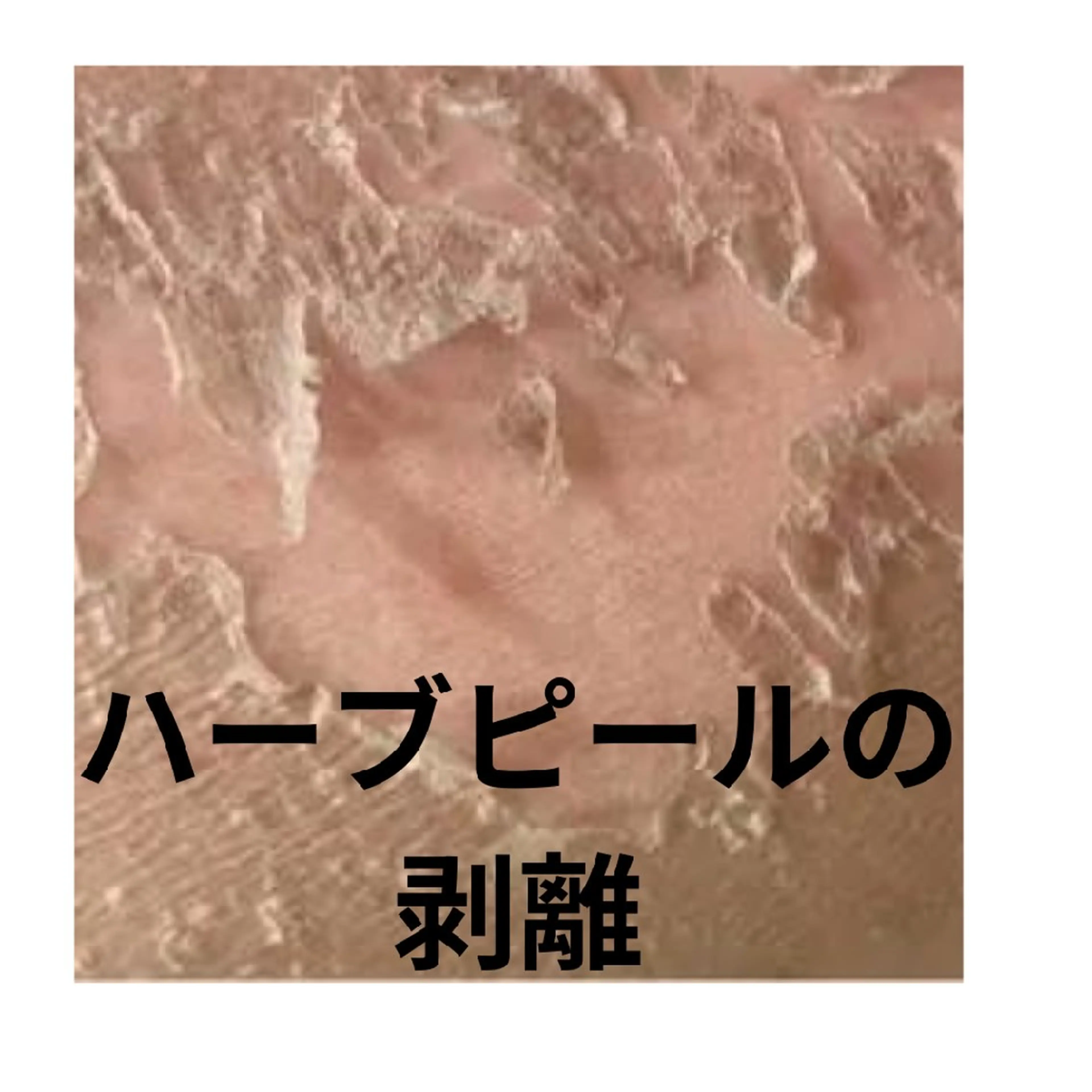 エステ ☺ハーブピール💕 ソフィアカロン💖のエステ・リラクイメージ