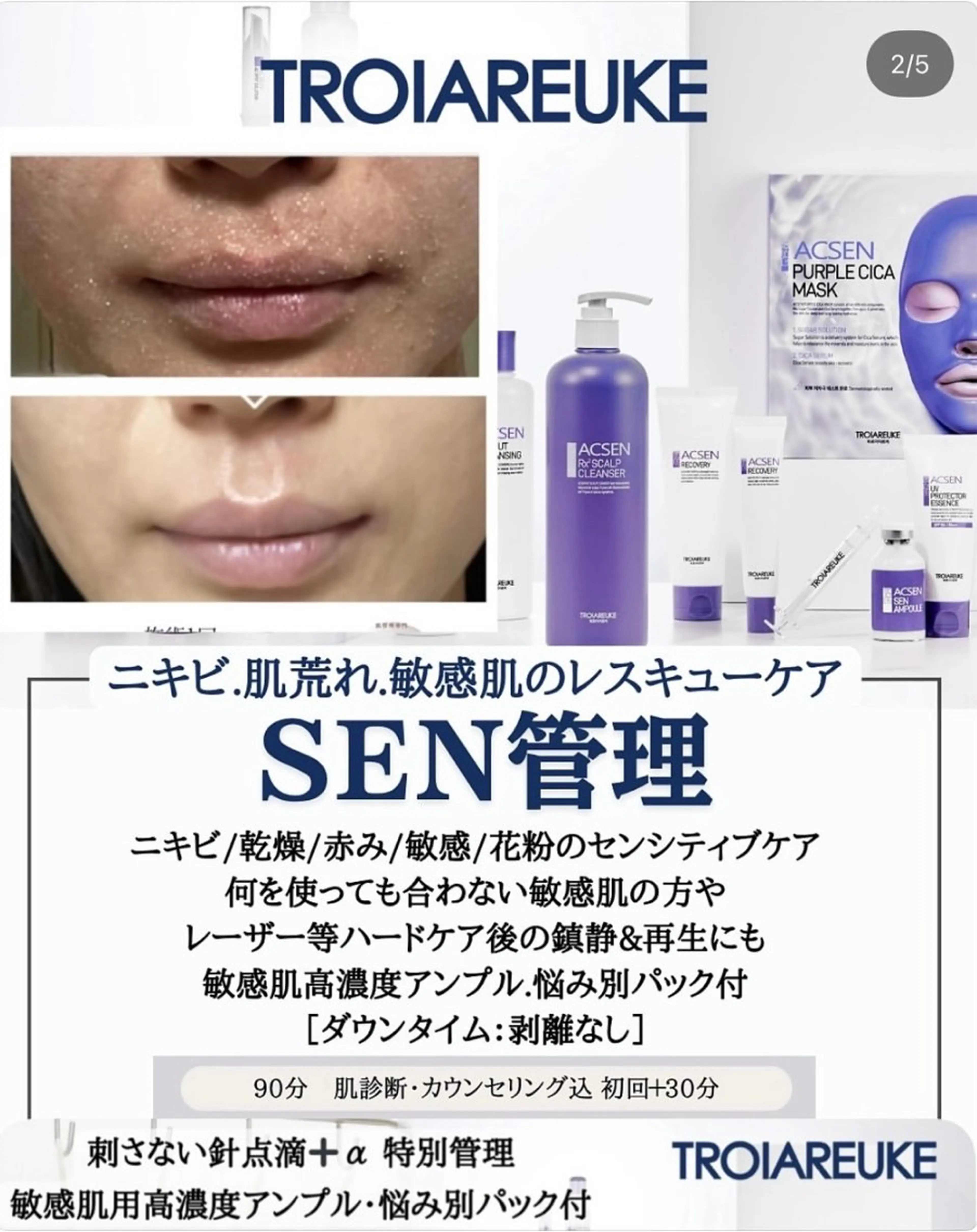 【赤み・ニキビ】春の敏感肌ケア♡ 敏感肌&肌荒れ肌を改善♡安定した素肌へ🌿スペシャル"SEN管理🩵"の写真