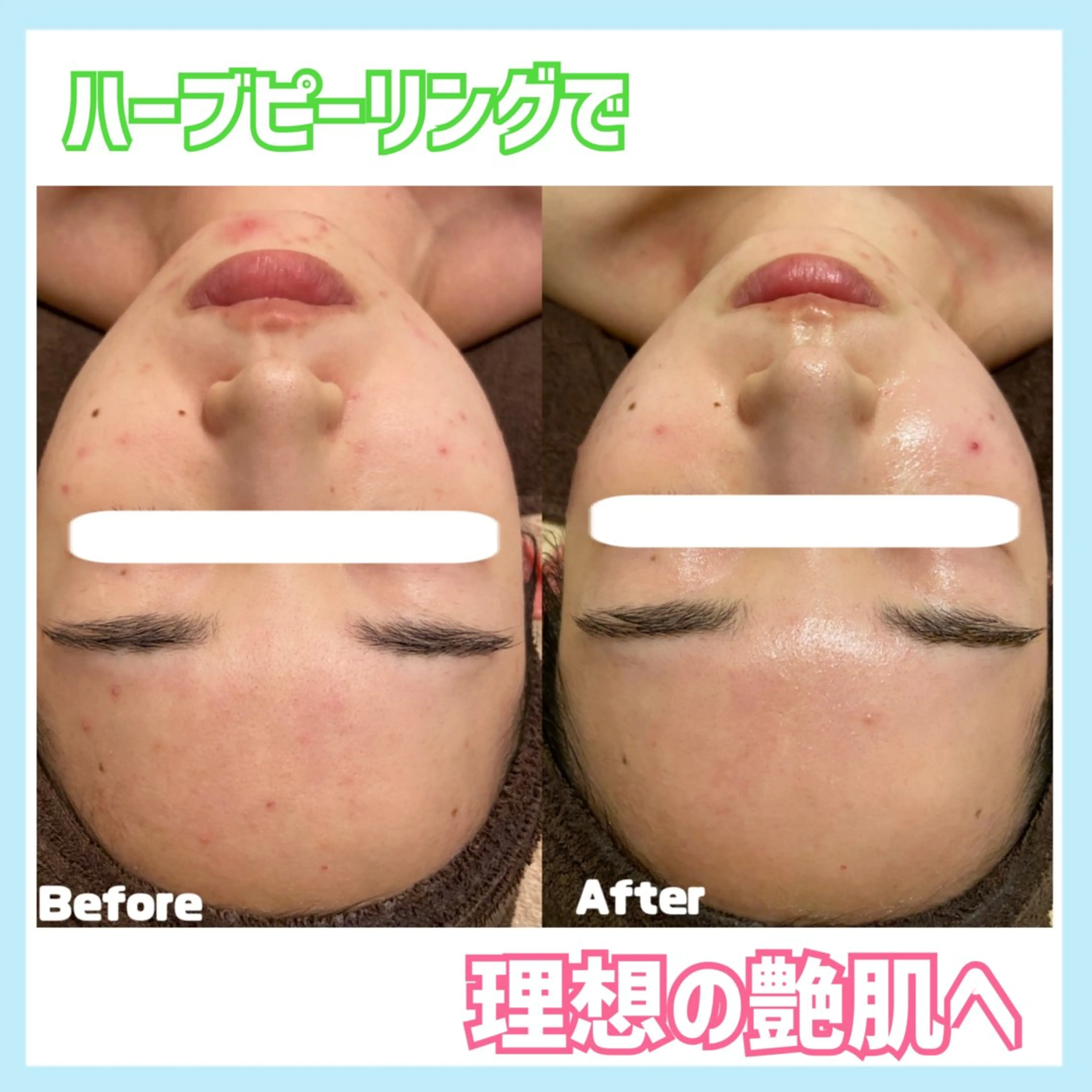 エステ オールハンド専門🤍 痩身/小顔/ ハーブのエステ・リラクイメージ