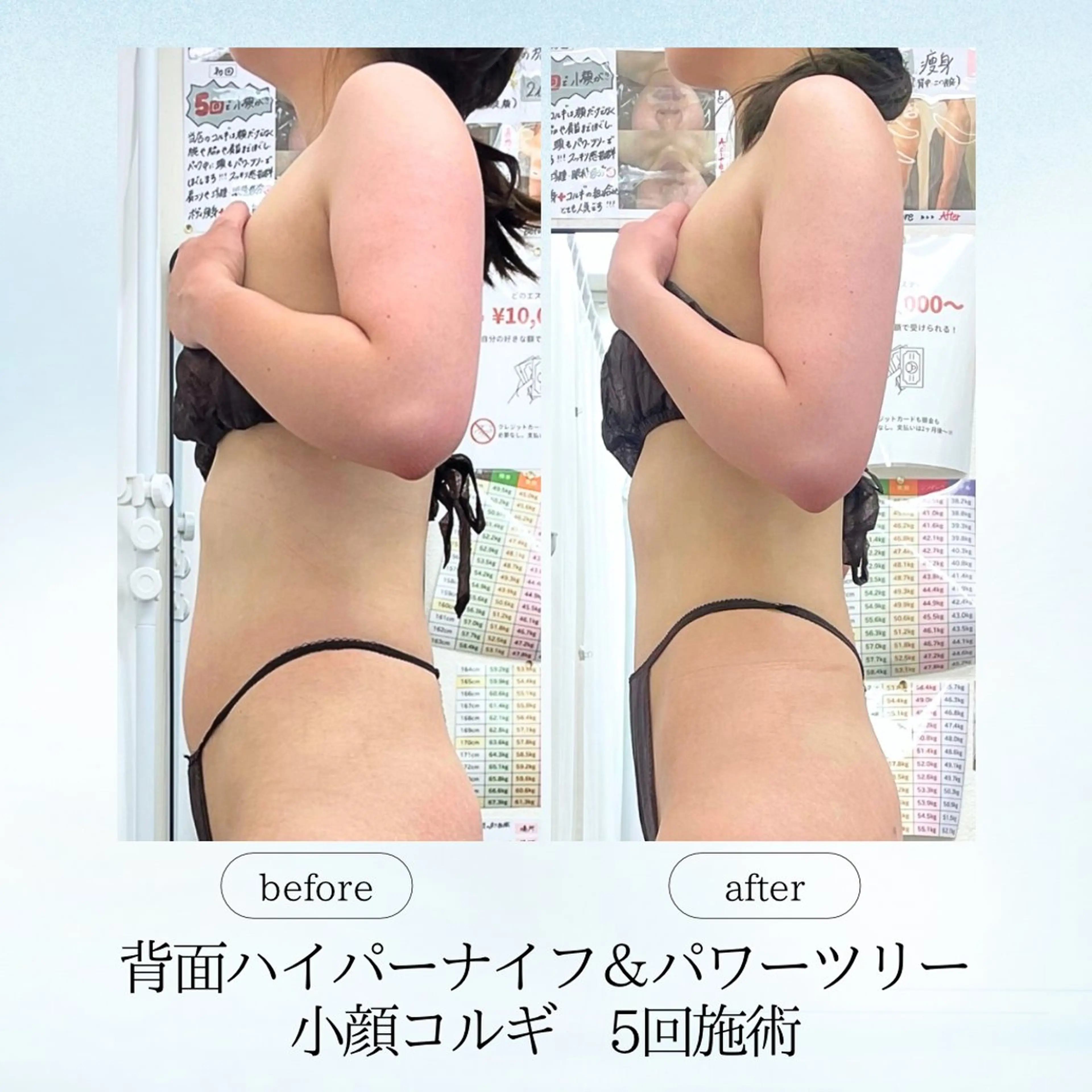 espresso,所属・《痩身、小顔専門店》 エスプレッソのエステ・リラクイメージ