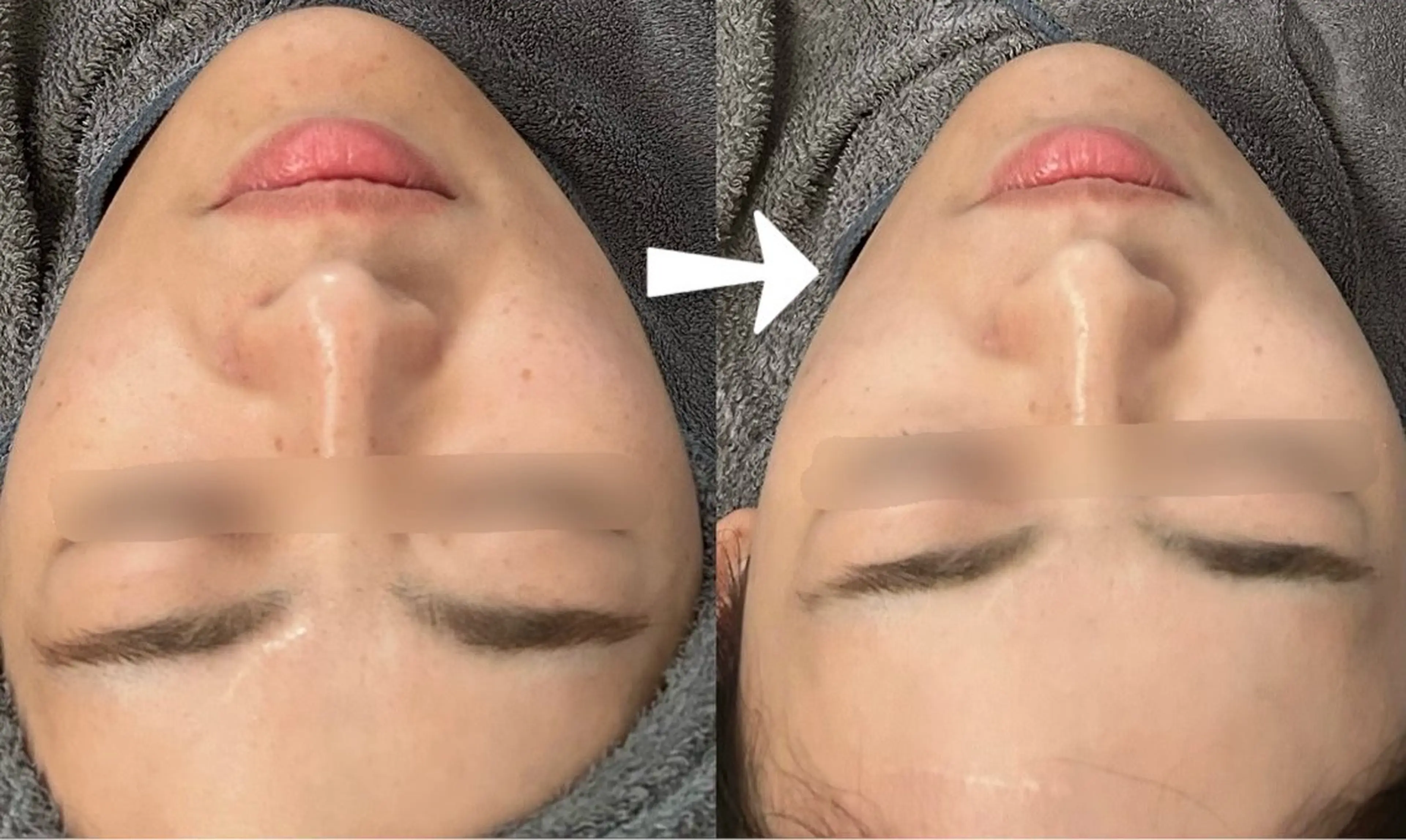 エステ Smoo アユミの眉毛・アイブロウイメージ