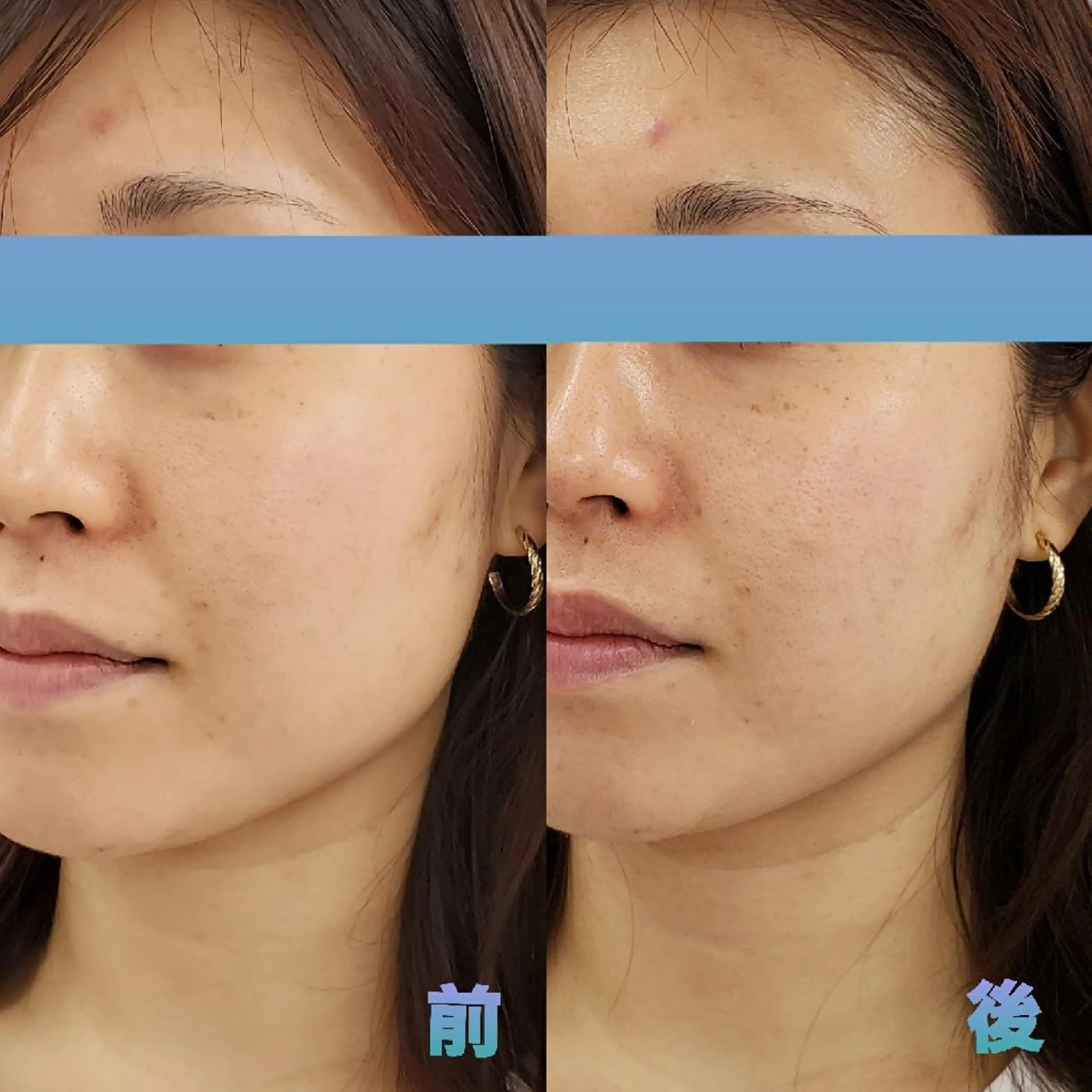 エステ リラク Nana no  Moeのエステ・リラクイメージ