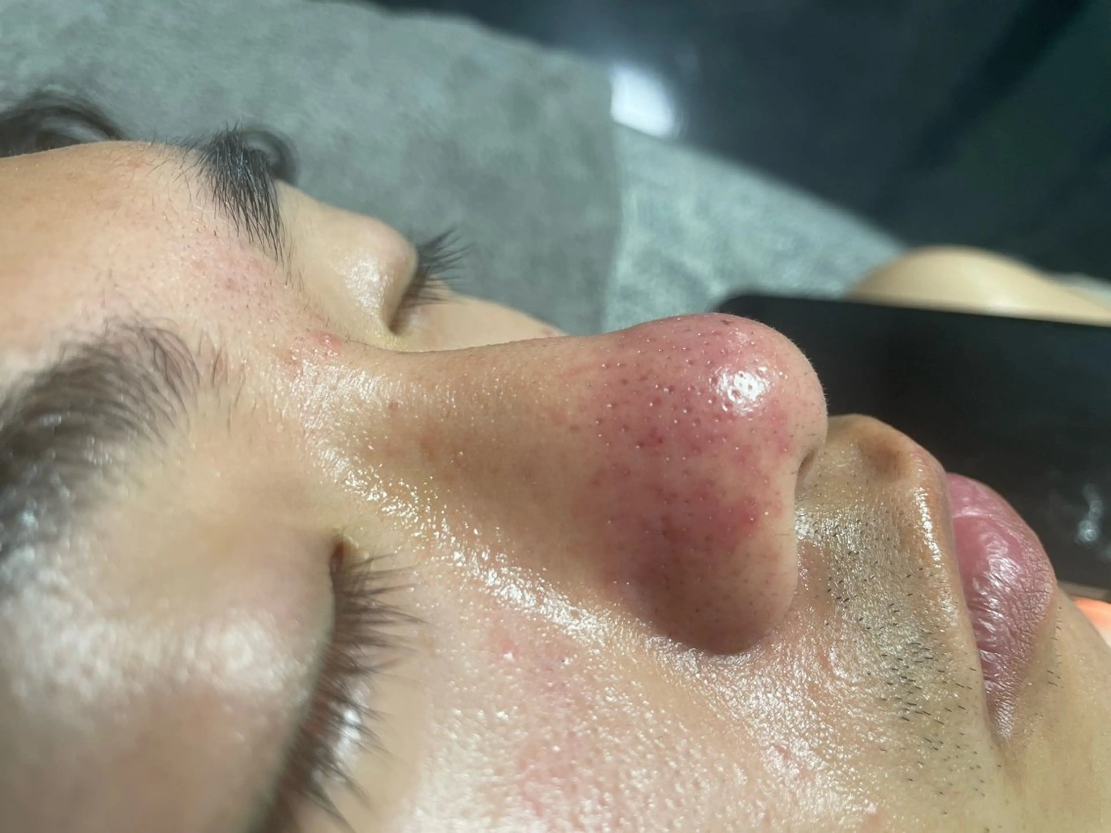 【角栓ケア】当店専売クレンジングプレゼント🎁の写真