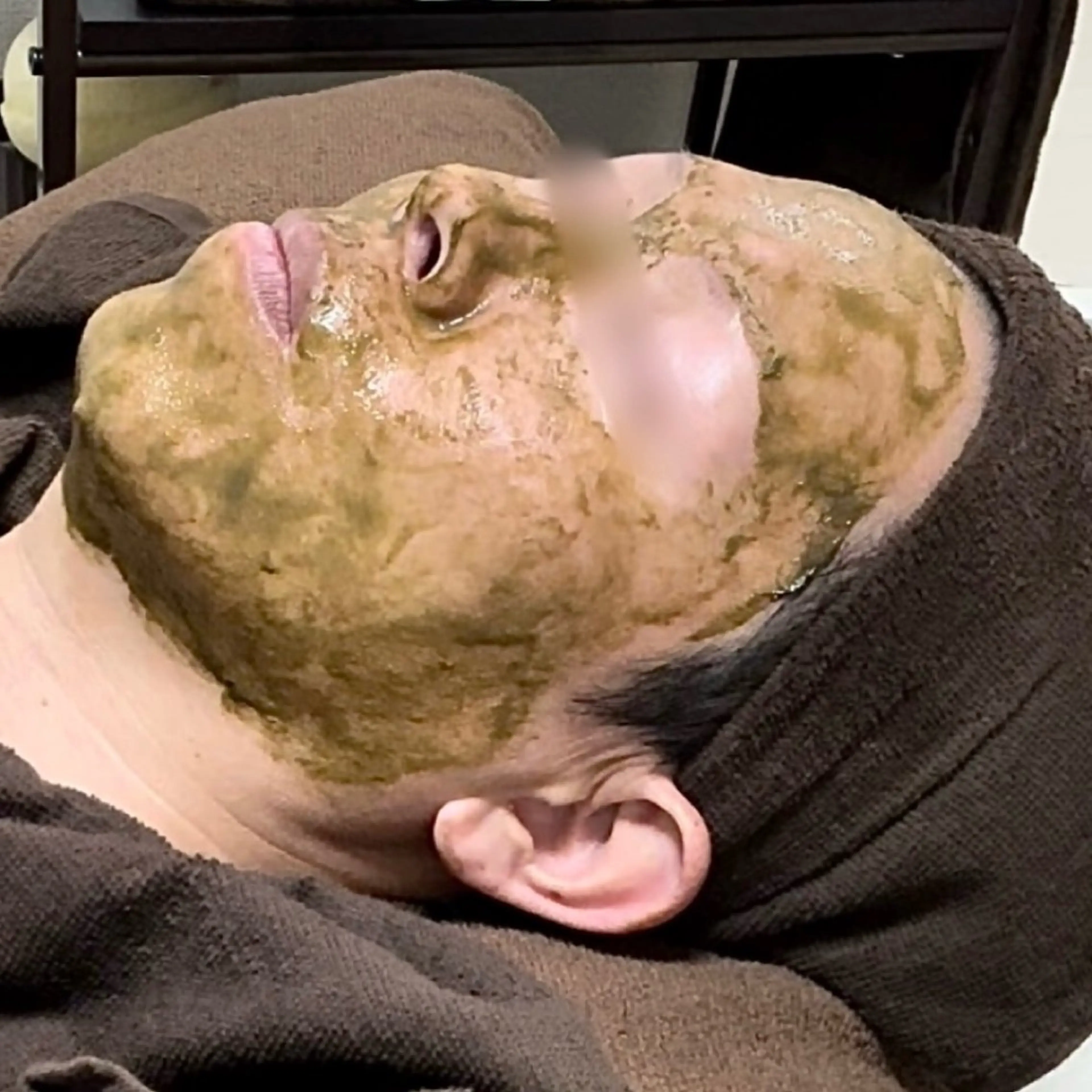 エステ ニキビ 毛穴ケア シャルム ココ みさのエステ・リラクイメージ