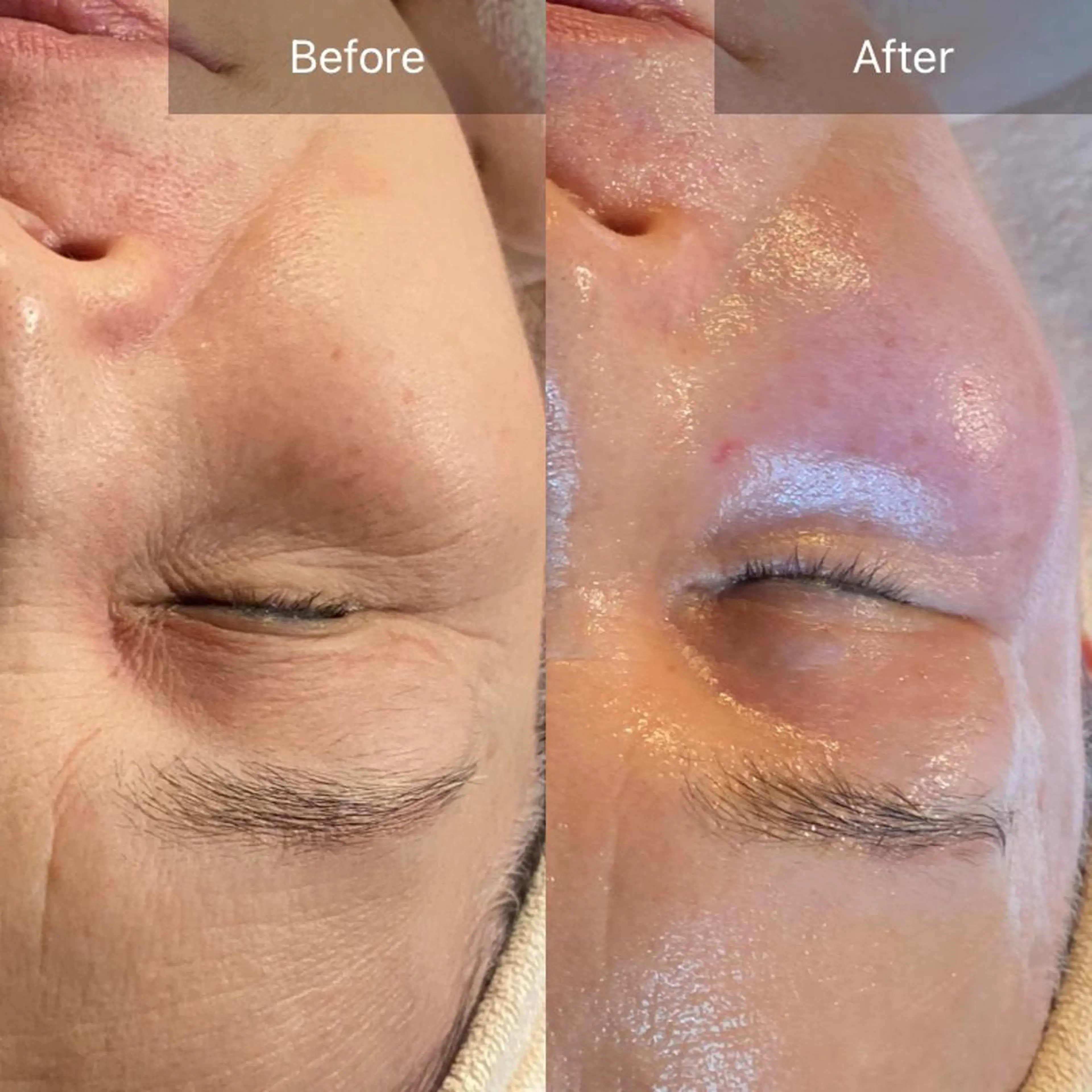 毛穴から始める肌メン テマンダリンオレンジのエステ・リラクイメージ