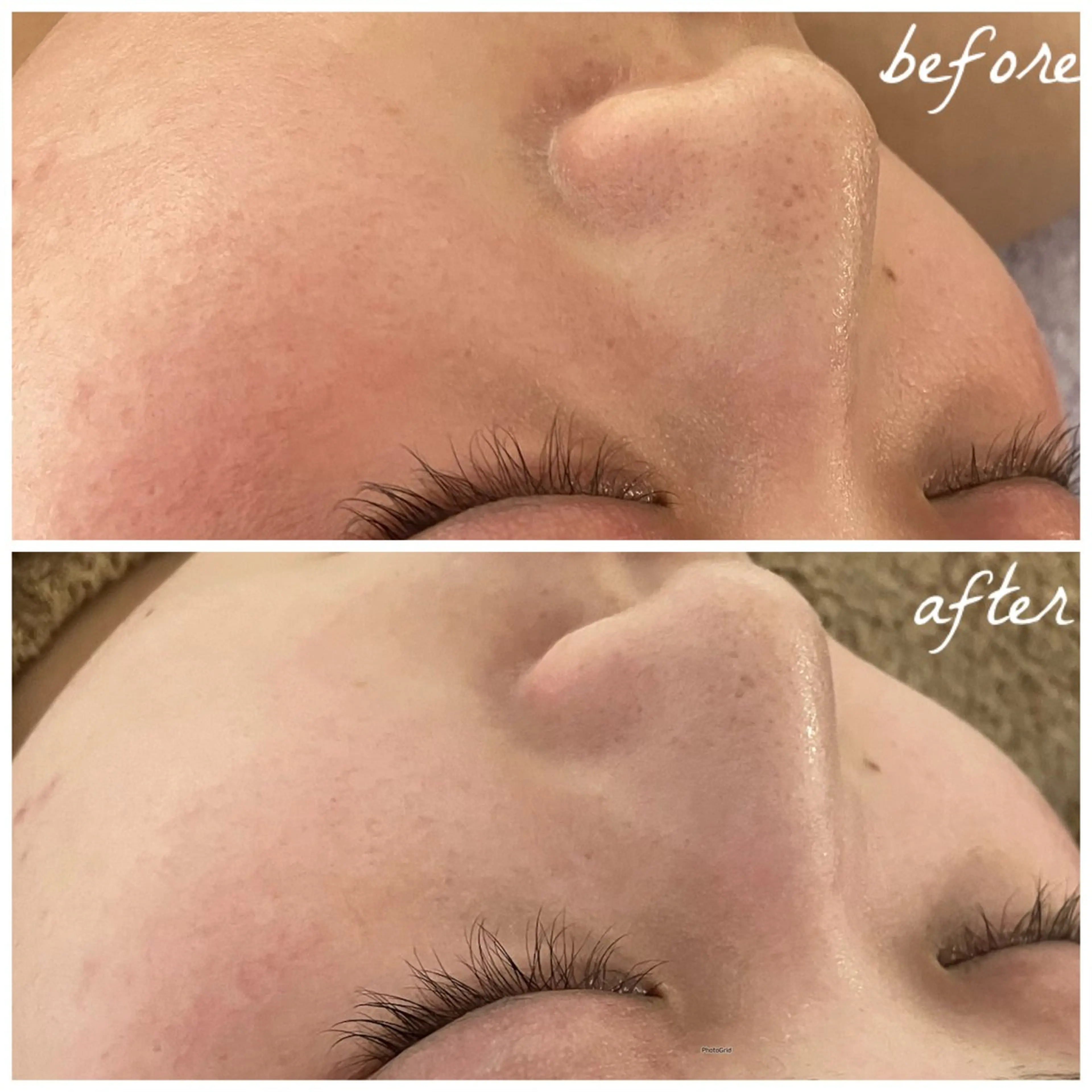 メンズ エステ メナード岐阜市茜部 杉浦のエステ・リラクイメージ