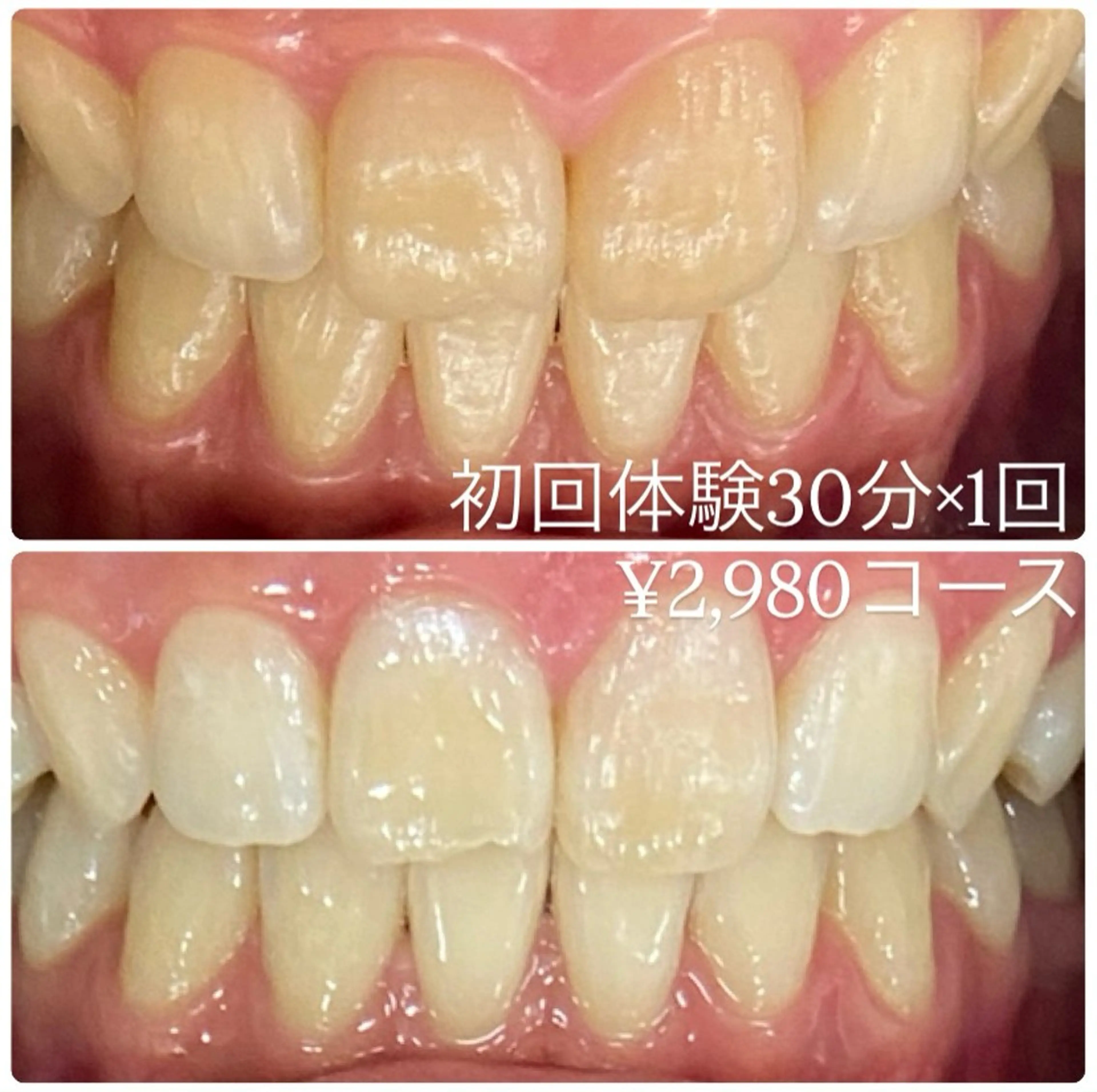 ホワイトニングルーム 横浜店のその他イメージ