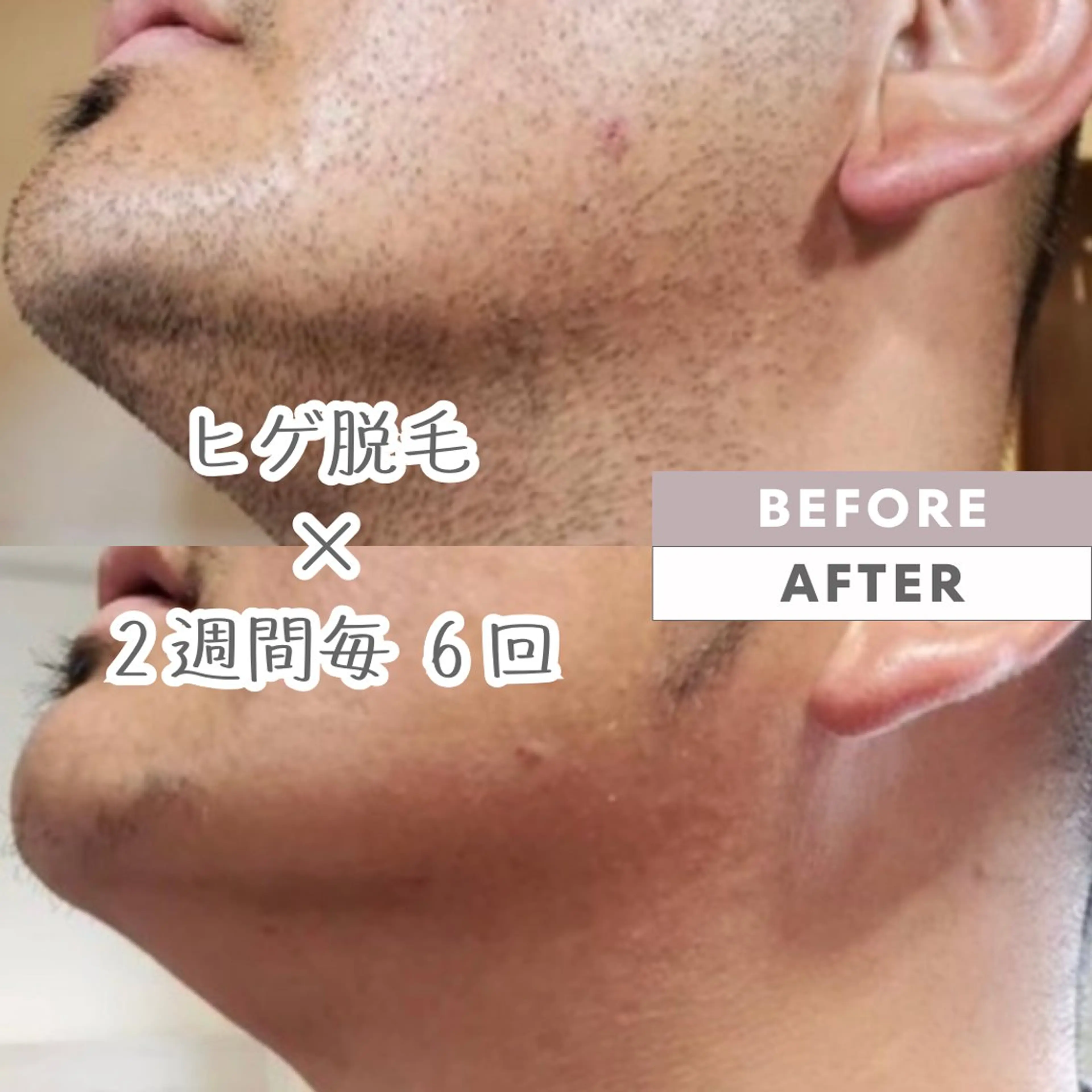 ROOM.S ｜脱毛｜美肌｜ボディのエステ・リラクイメージ