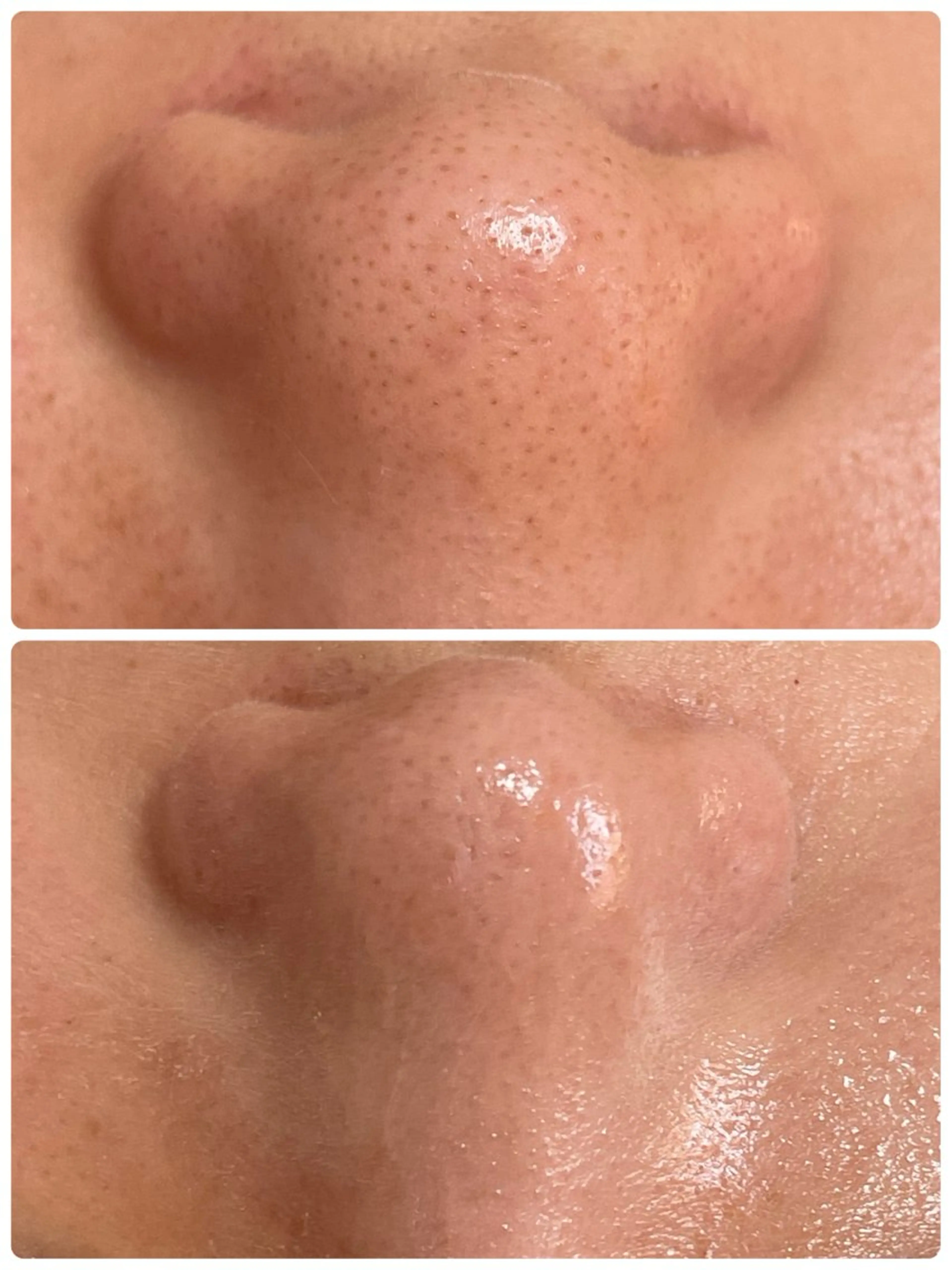 エステ 肌質改善専門店/絹々(きぬ)所属・心満たされる ハーブピーリング絹々のエステ・リラクイメージ