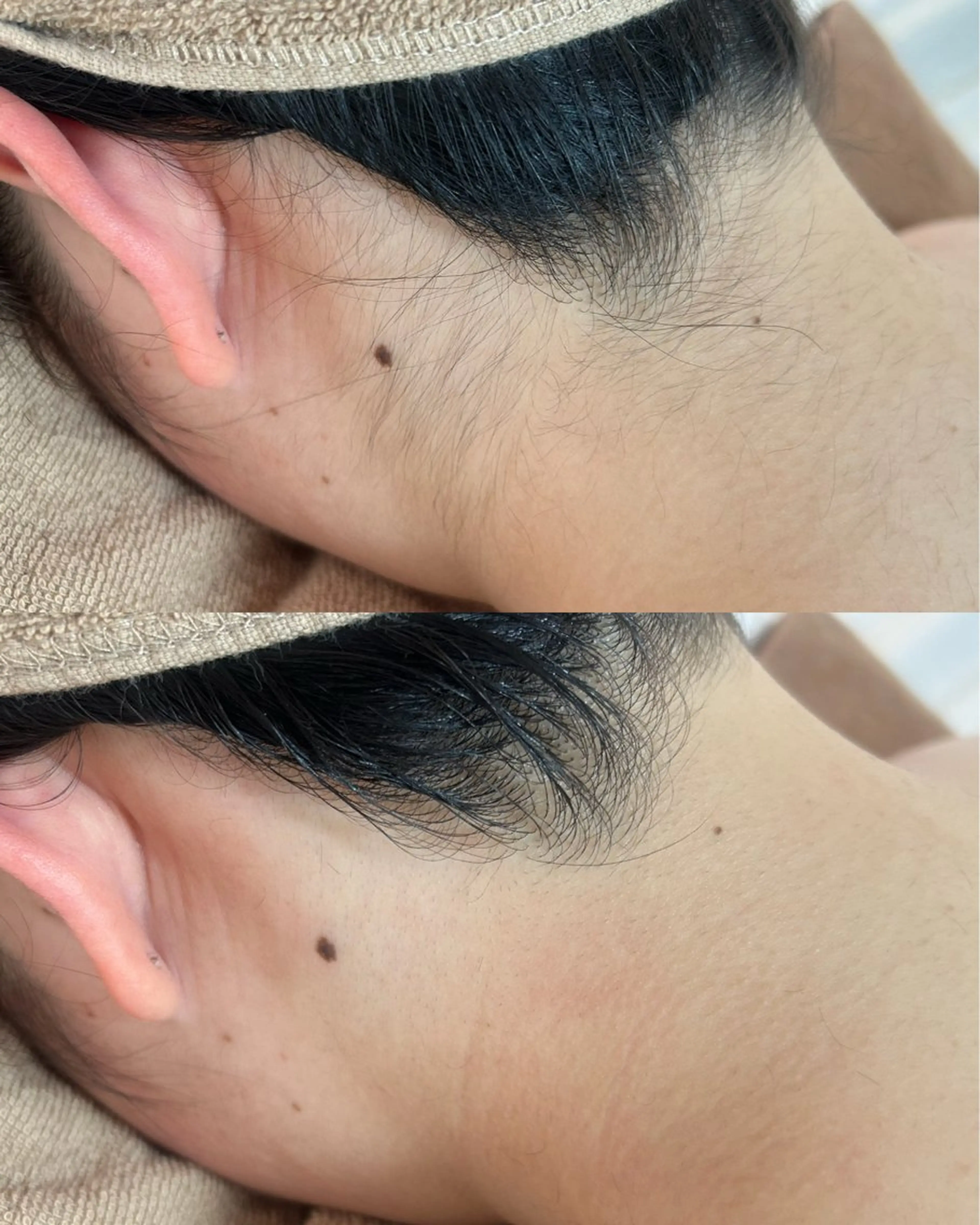 脱毛 Be Charm 山﨑のエステ・リラクイメージ