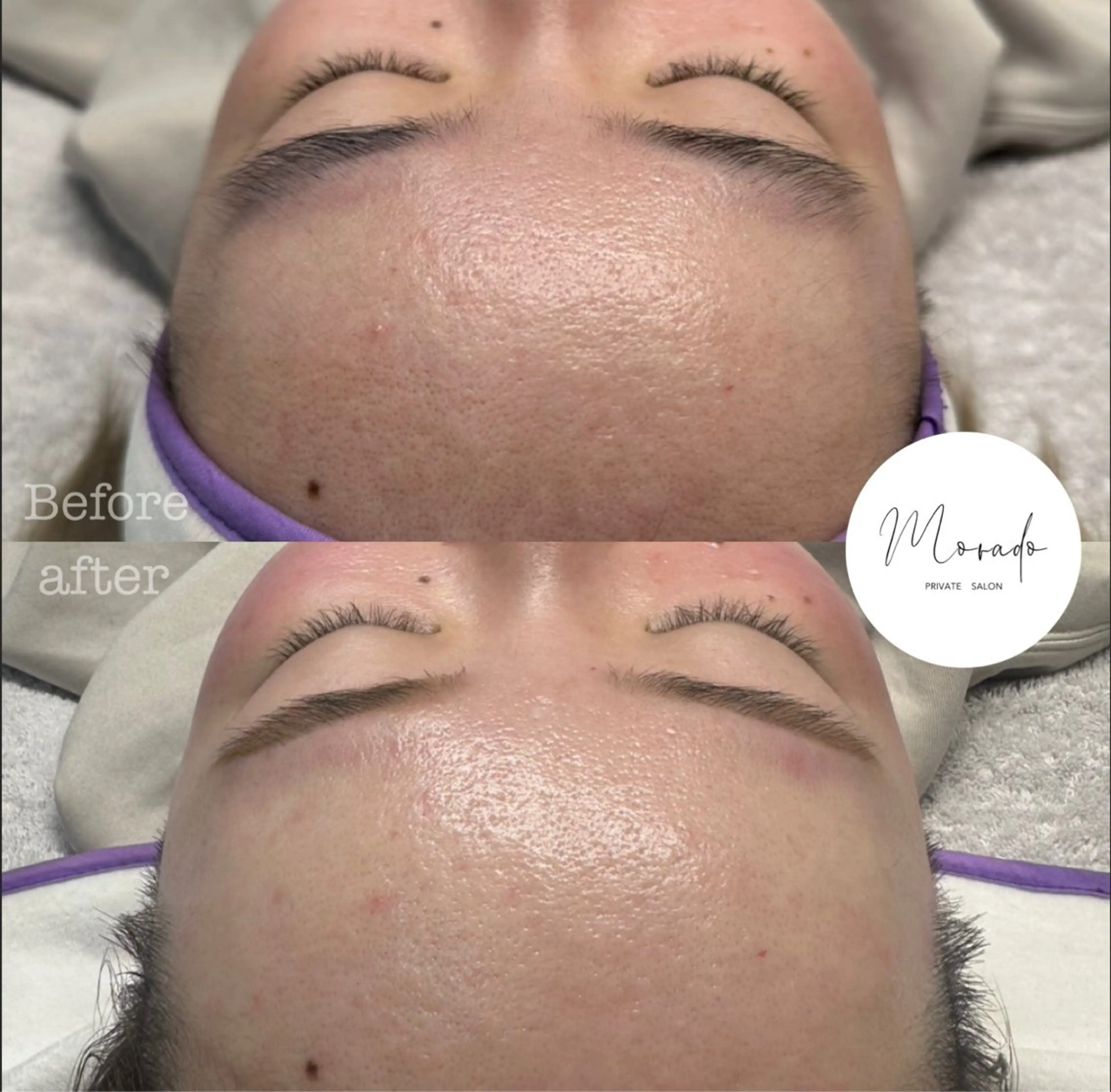 MORADO hazukiの眉毛・アイブロウイメージ