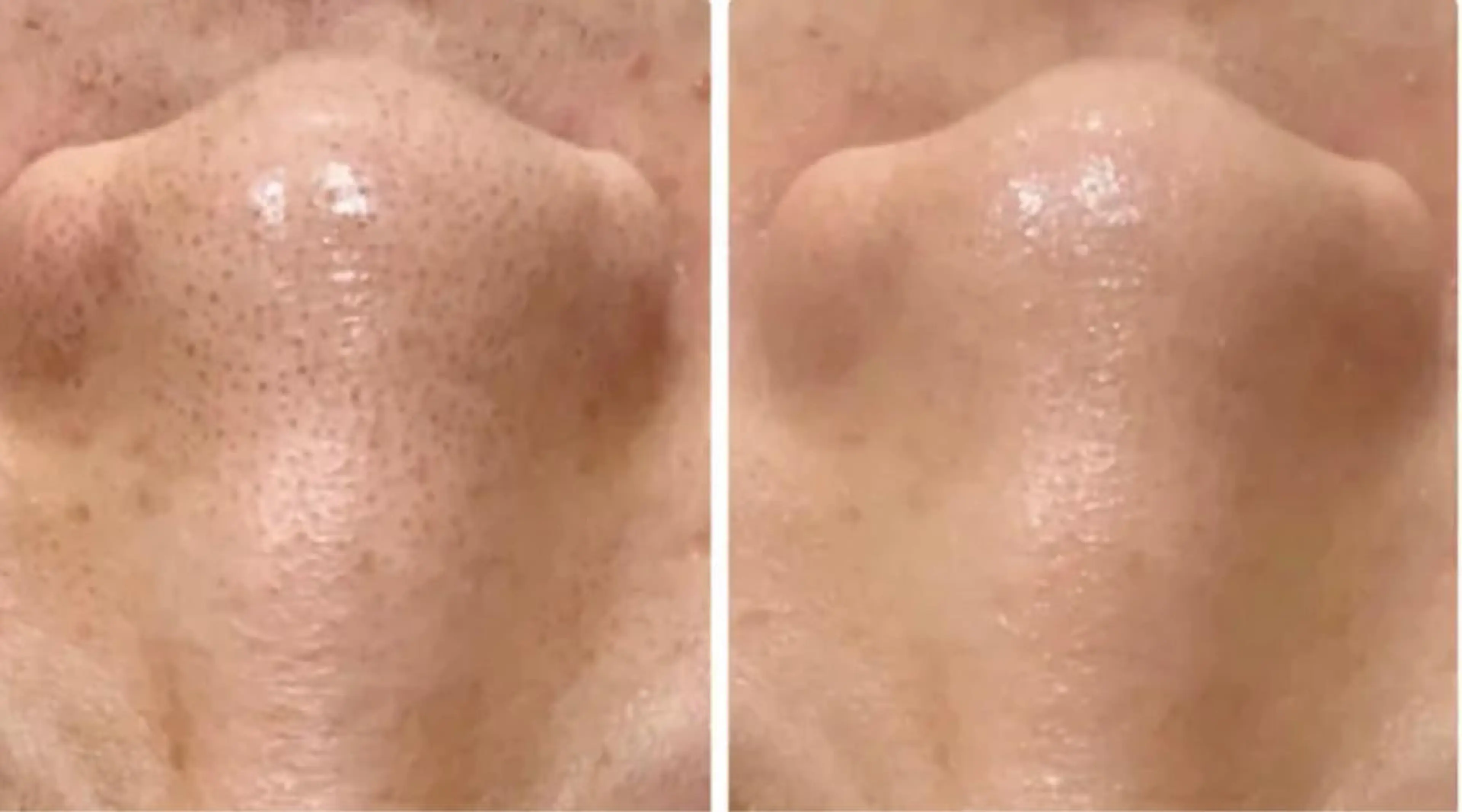 エステ トラブル肌改善🏥 Meow！🫧🫧のその他イメージ