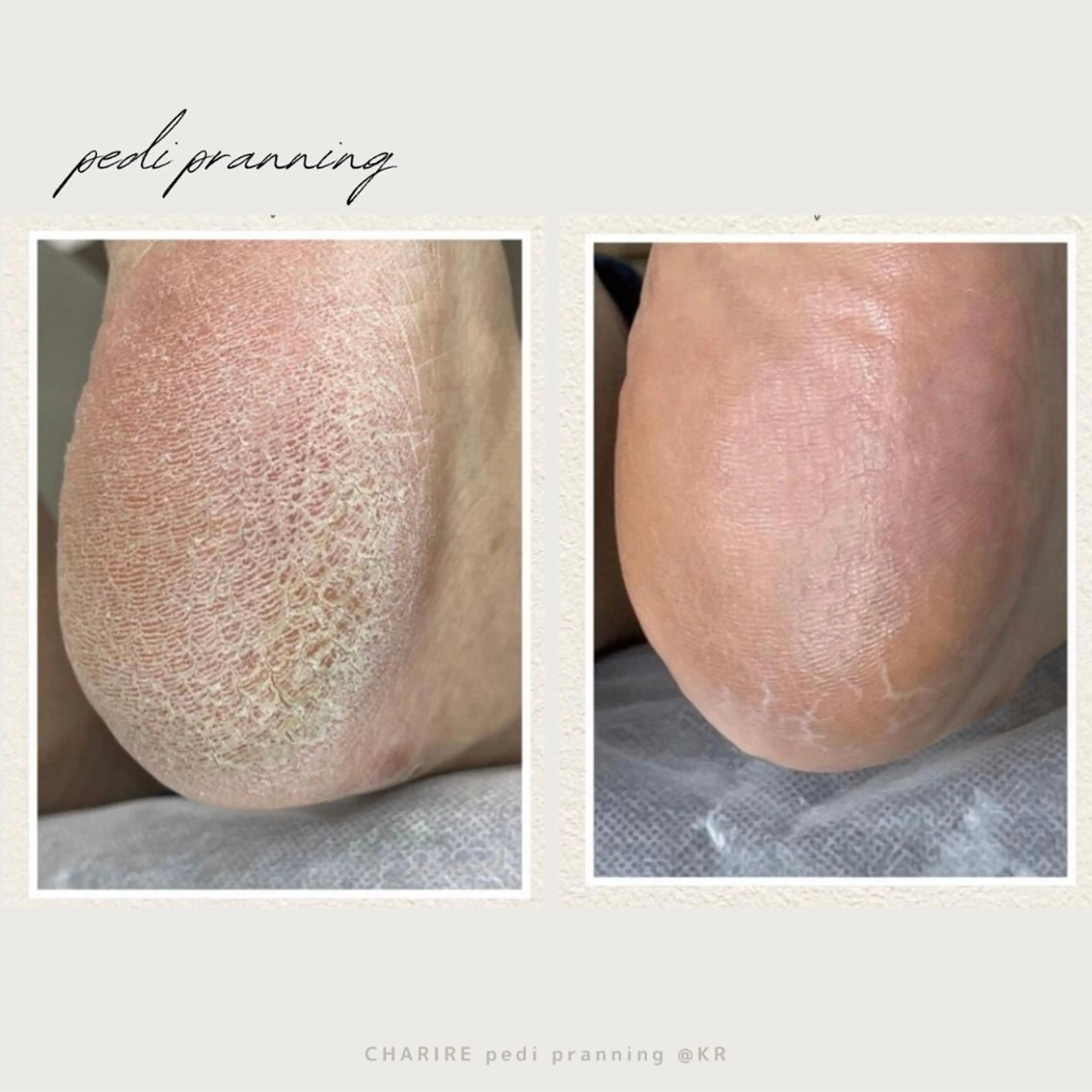 ネイル 韓国ネイル CHARIRE所属・CHARIRE chinatsuのマツエク・マツパデザイン