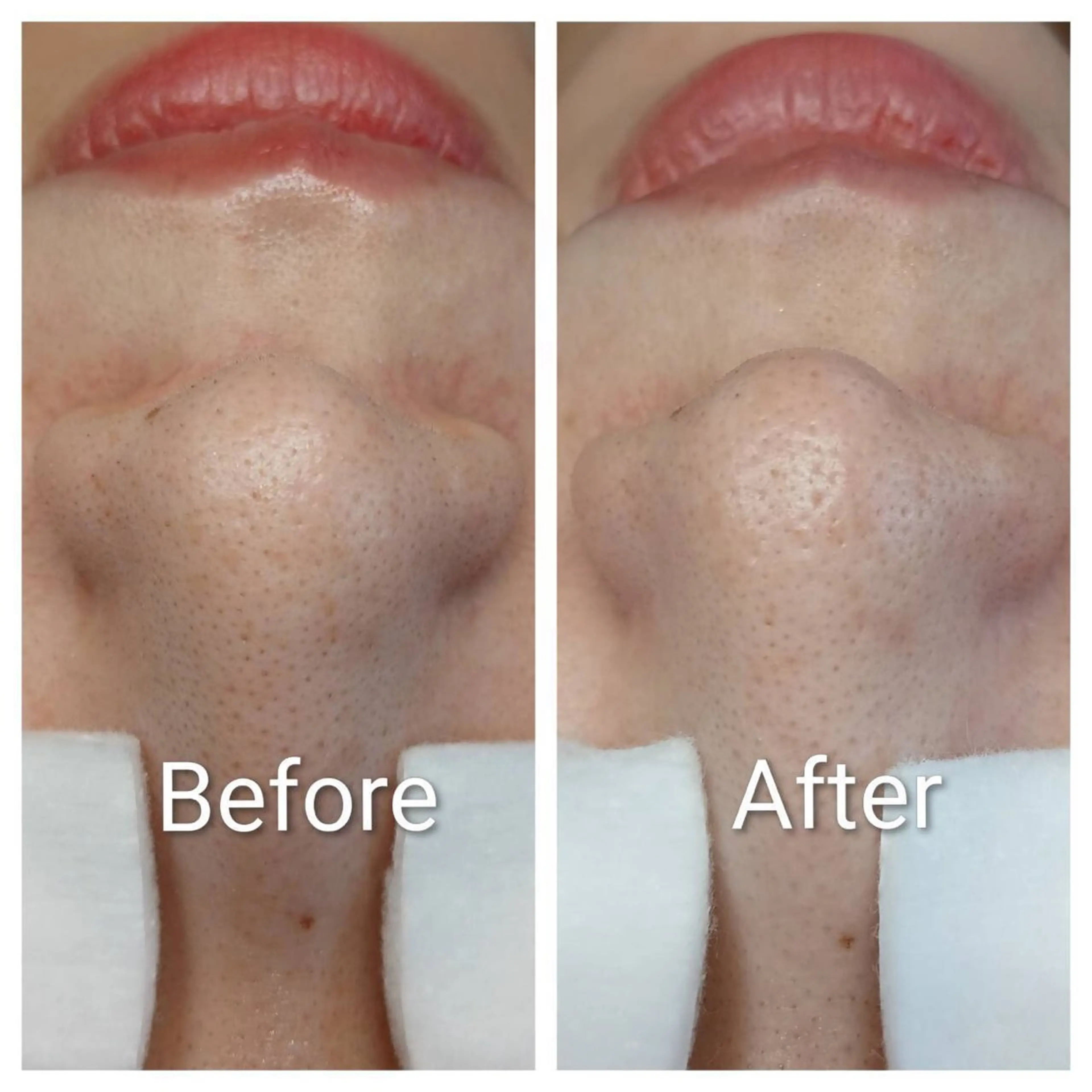 ポアレスサロン フィルのエステ・リラクイメージ