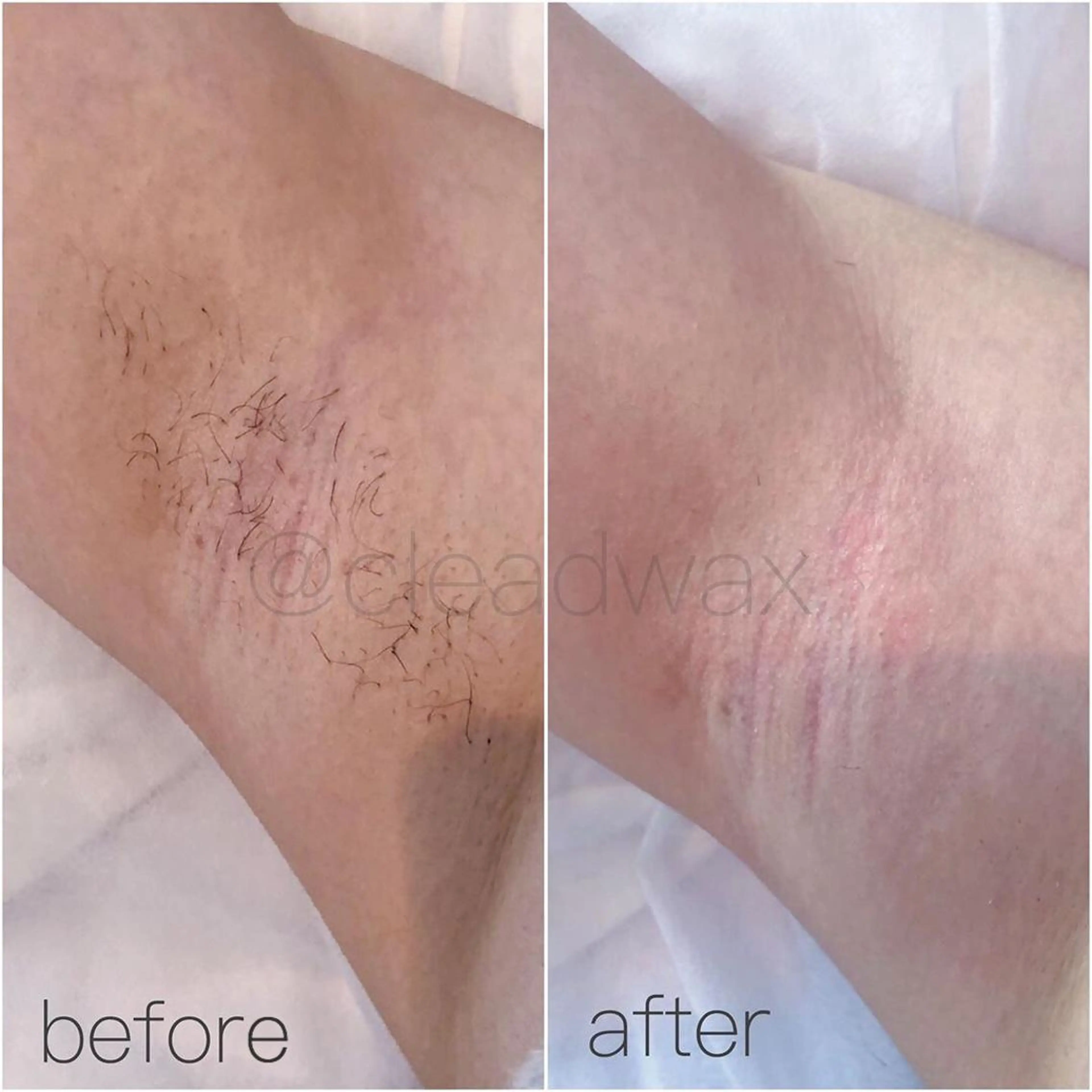 CLEAD 赤坂のエステ・リラクイメージ