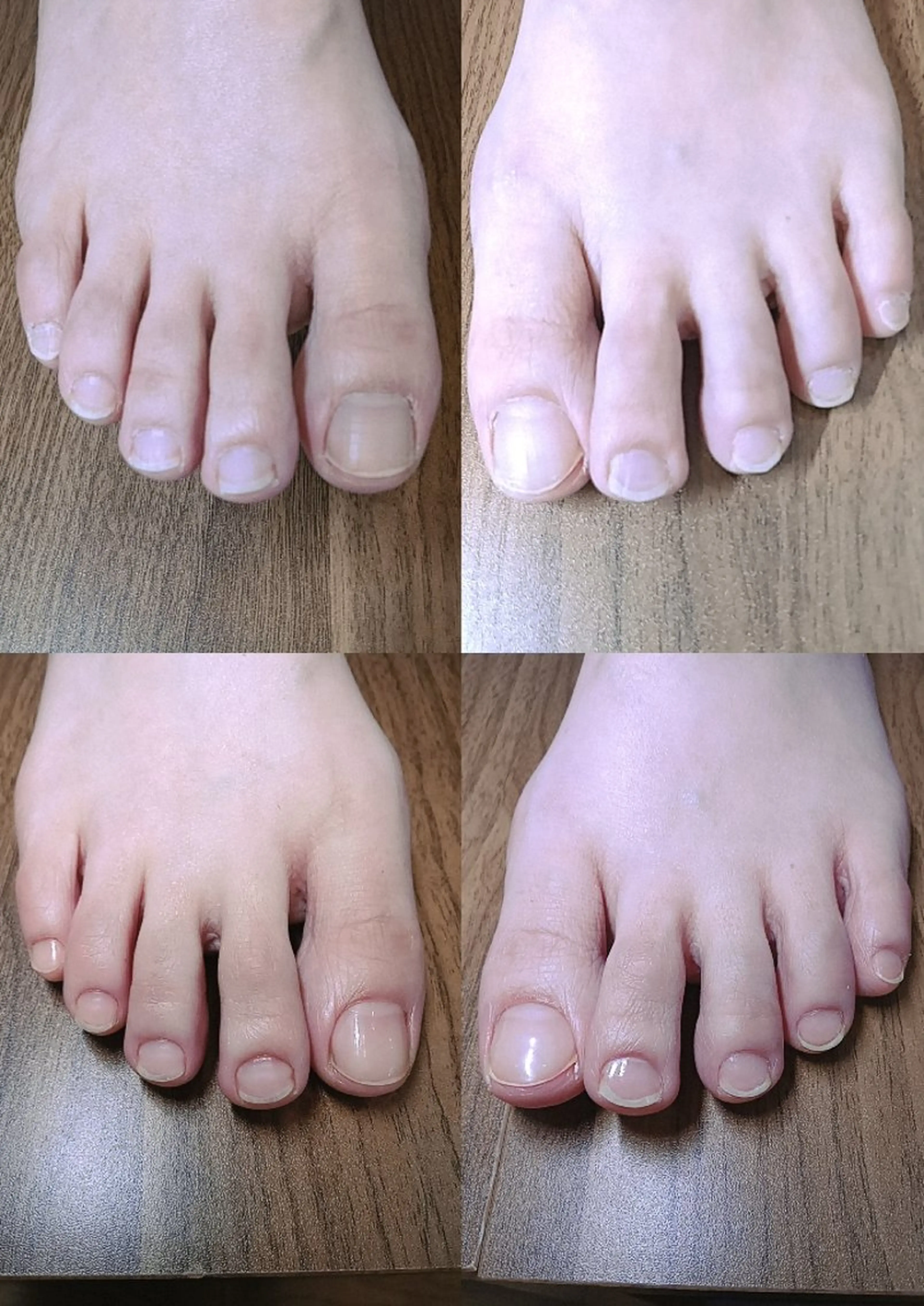 ネイル フットネイル 【まみ】 Ka Pilinaのネイルデザイン