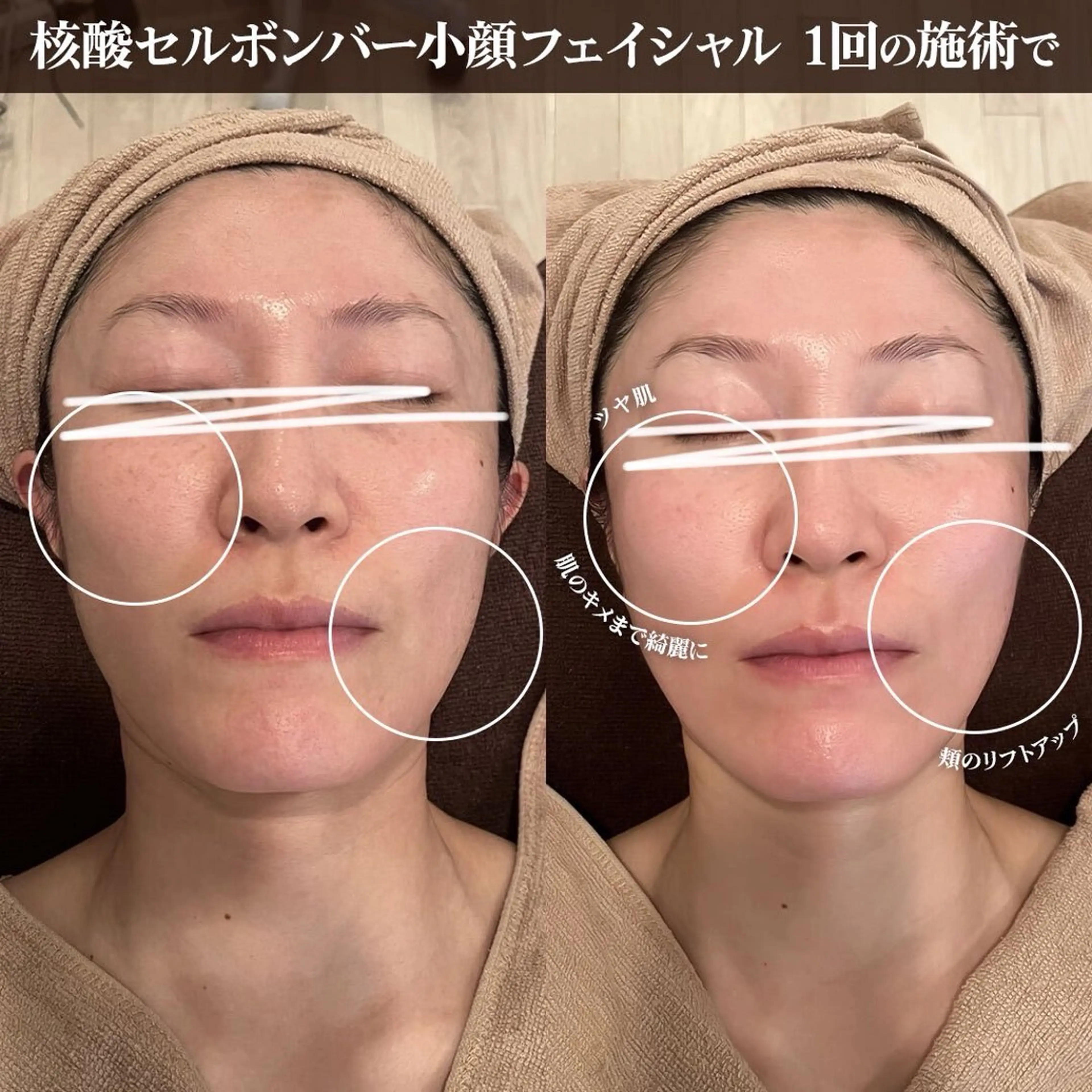 エステ トータルビューティー サロンキノセ折井のエステ・リラクイメージ