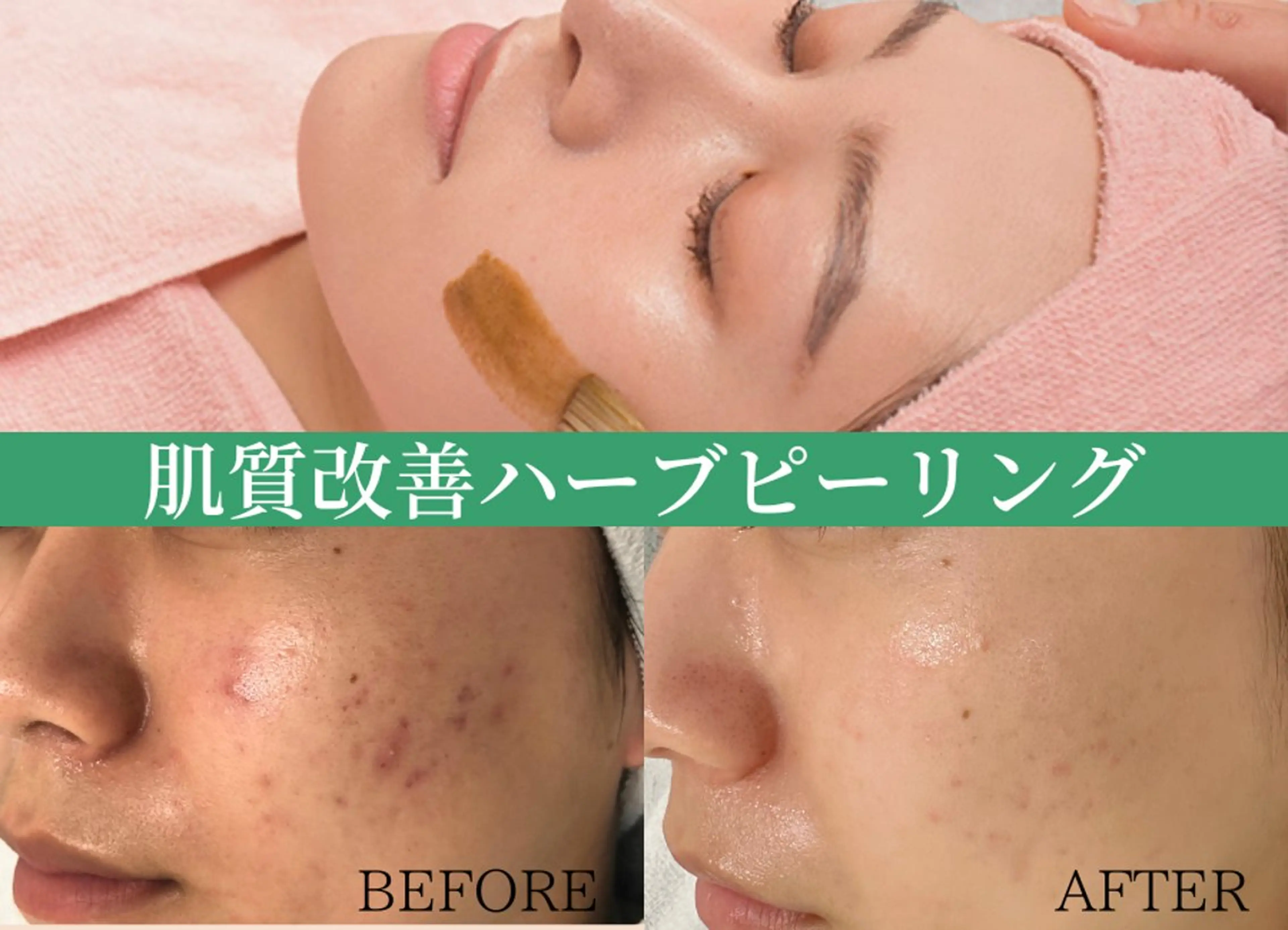 エステ BestBelleꕤ 大阪福島/肌質改善のエステ・リラクイメージ